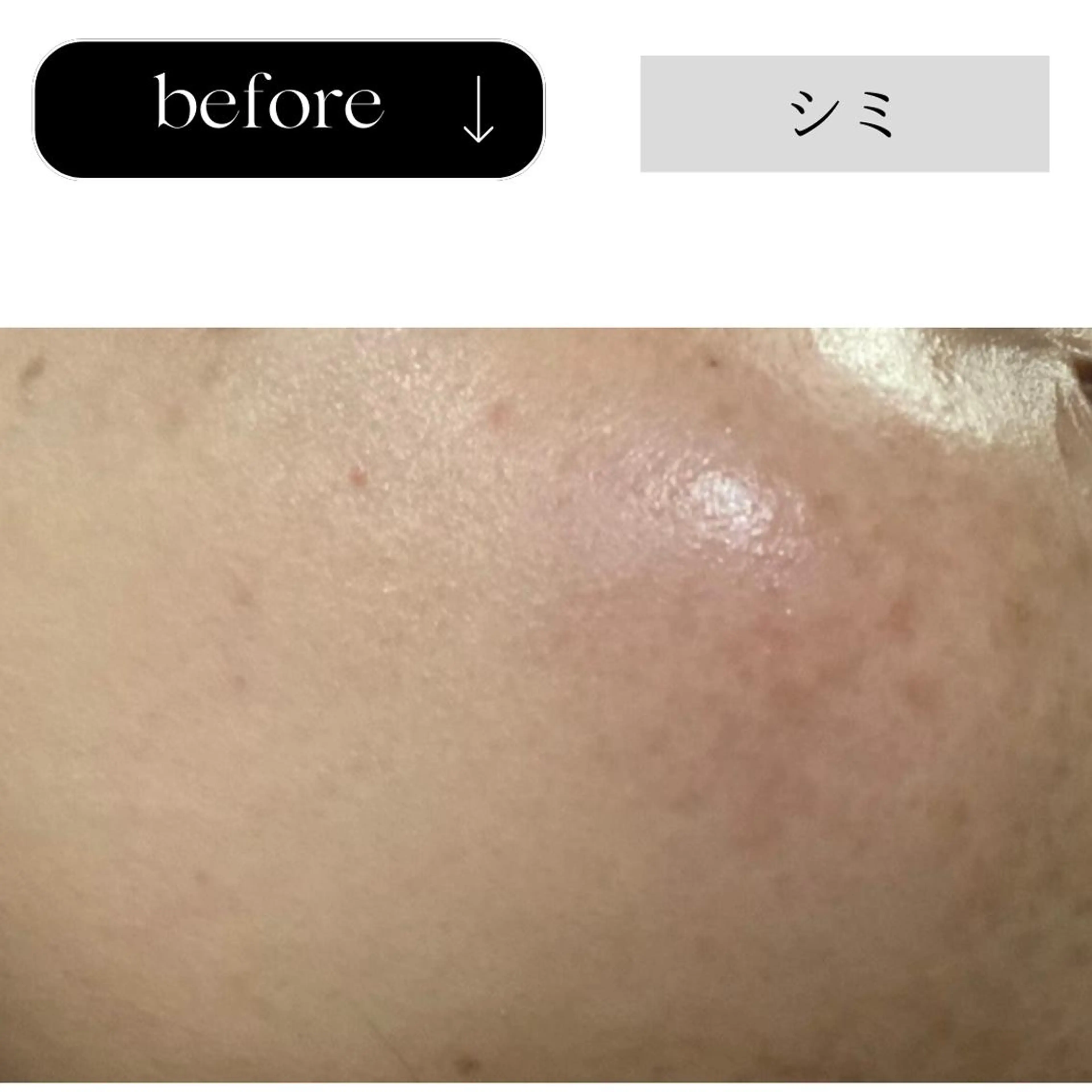 beauty CHOOSEのマツエク・マツパデザイン