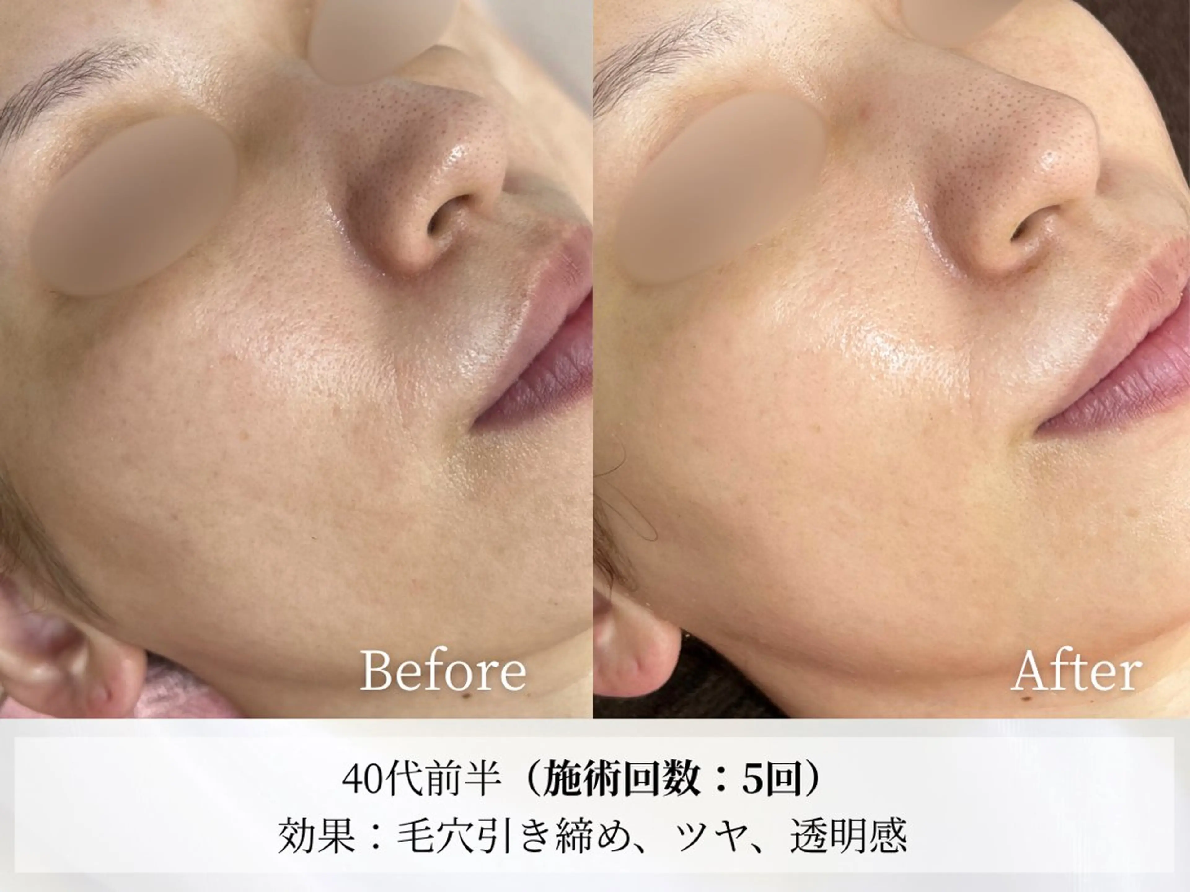 Astorie SHIORIのエステ・リラクイメージ