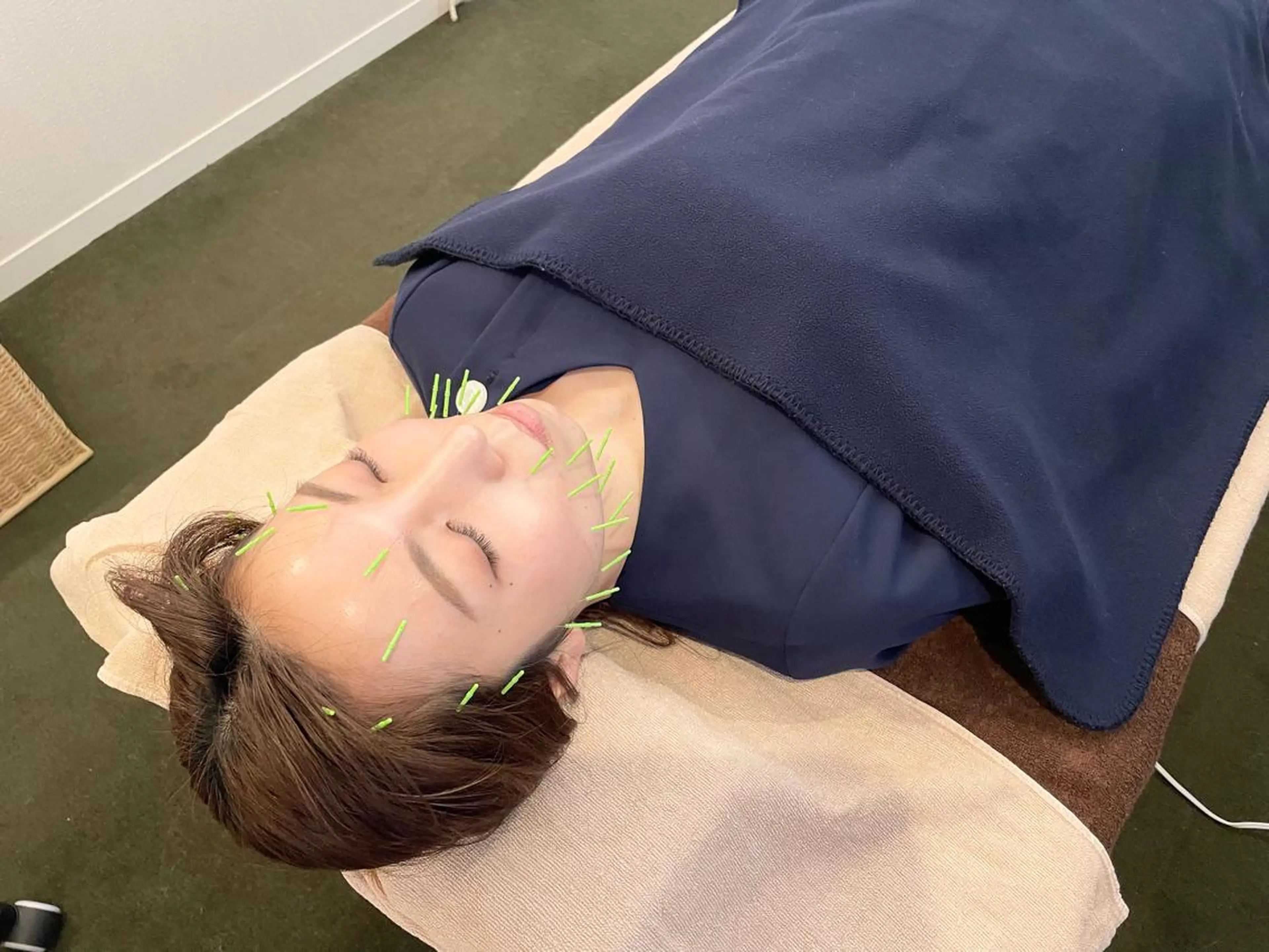 美容鍼　蒼月-aotsuki-所属・美容鍼「蒼月」 -アオツキ-のエステ・リラクイメージ