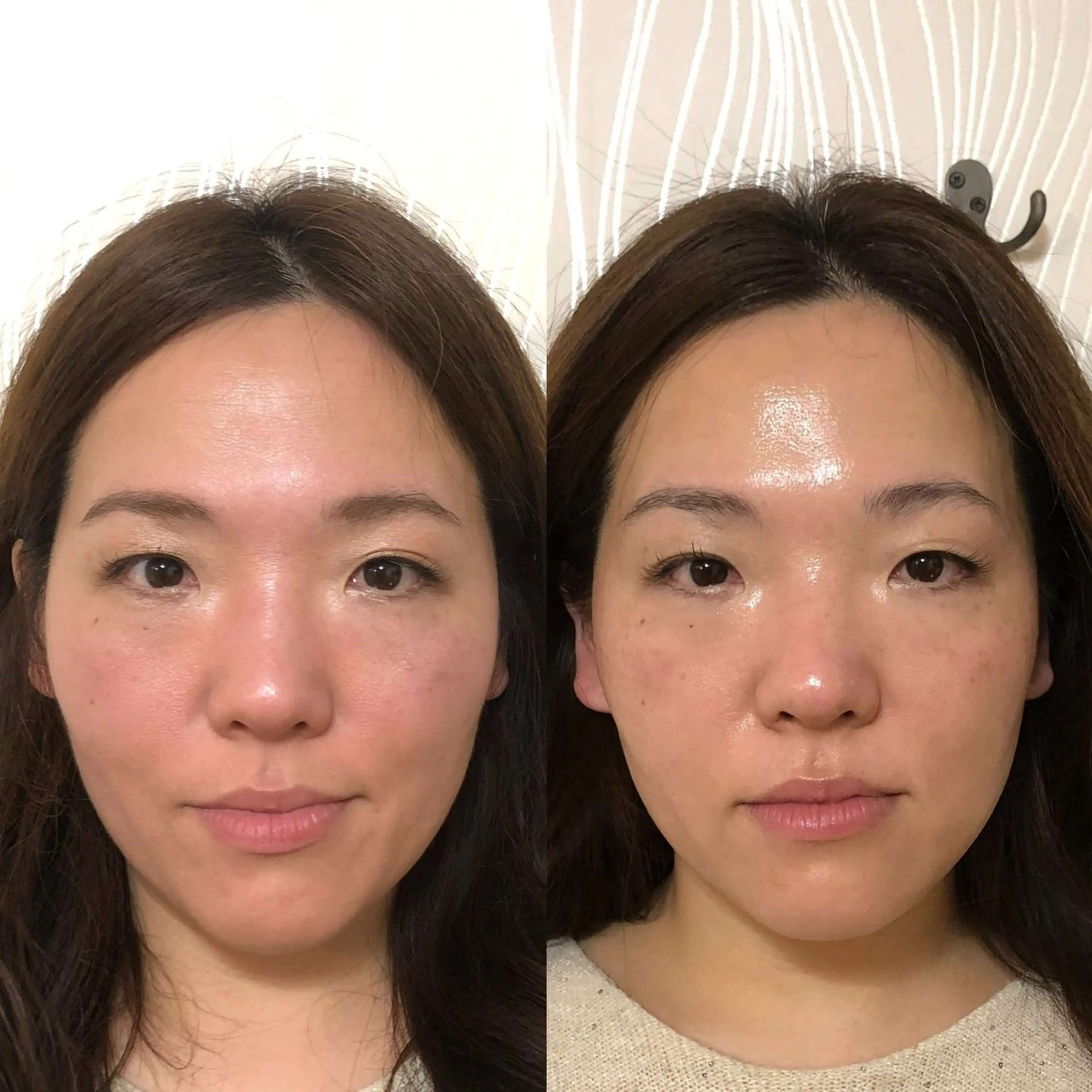 毛穴シミケア専門店aloha malie所属・水野 彩のエステ・リラクイメージ