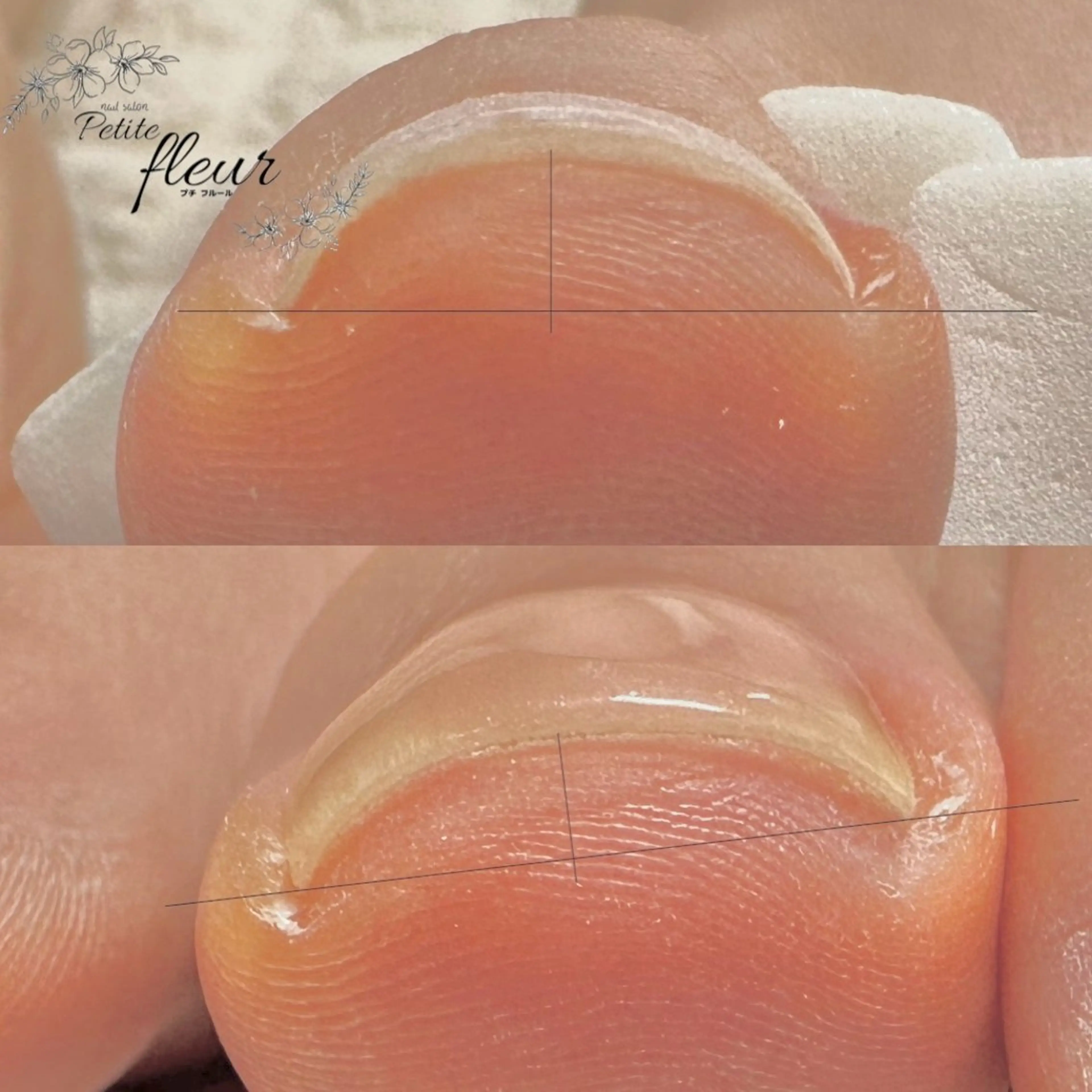 ネイル フットネイル ❁⃘*。Petite fleur❁⃘*りさのネイルデザイン