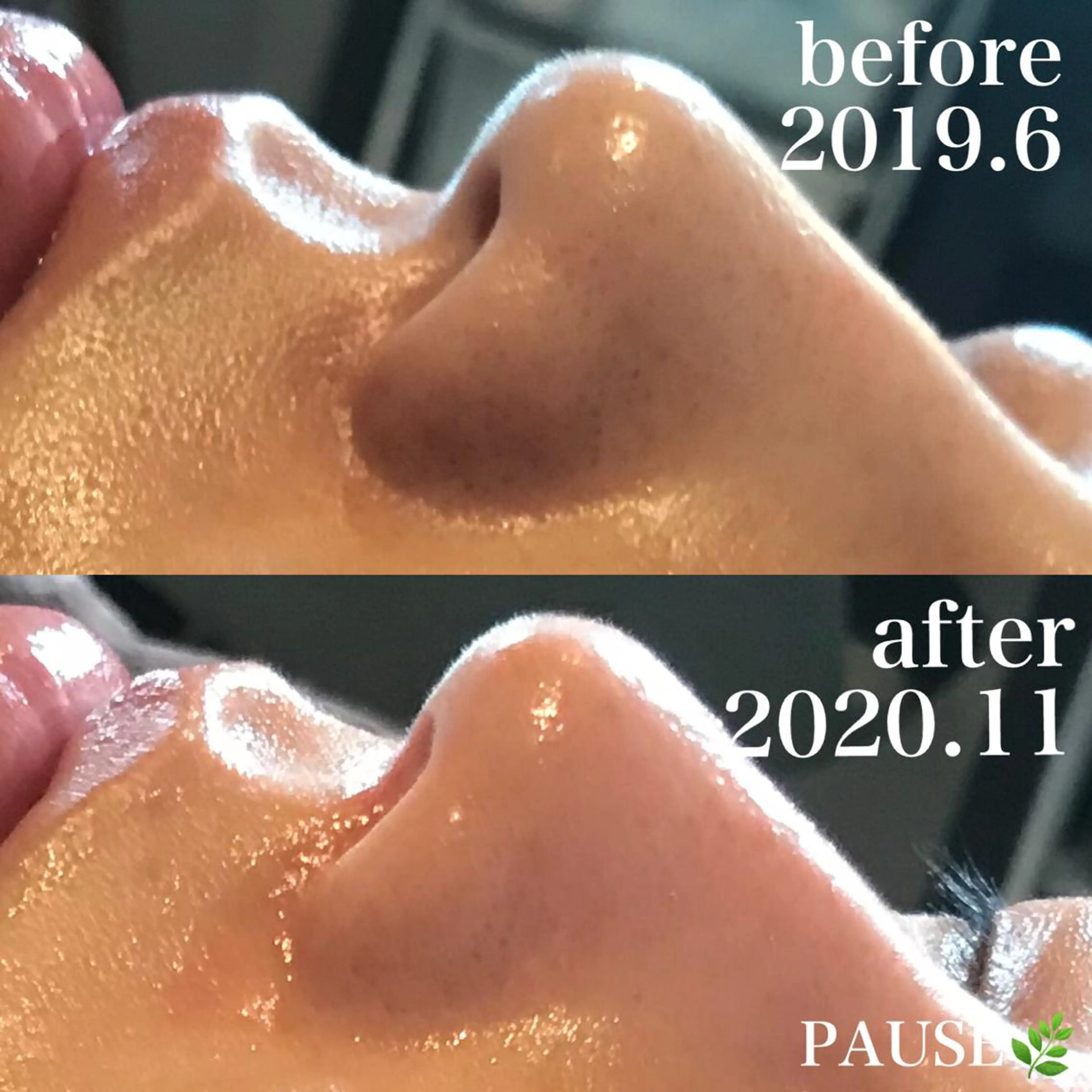 エステ 浜野 恵美のエステ・リラクイメージ