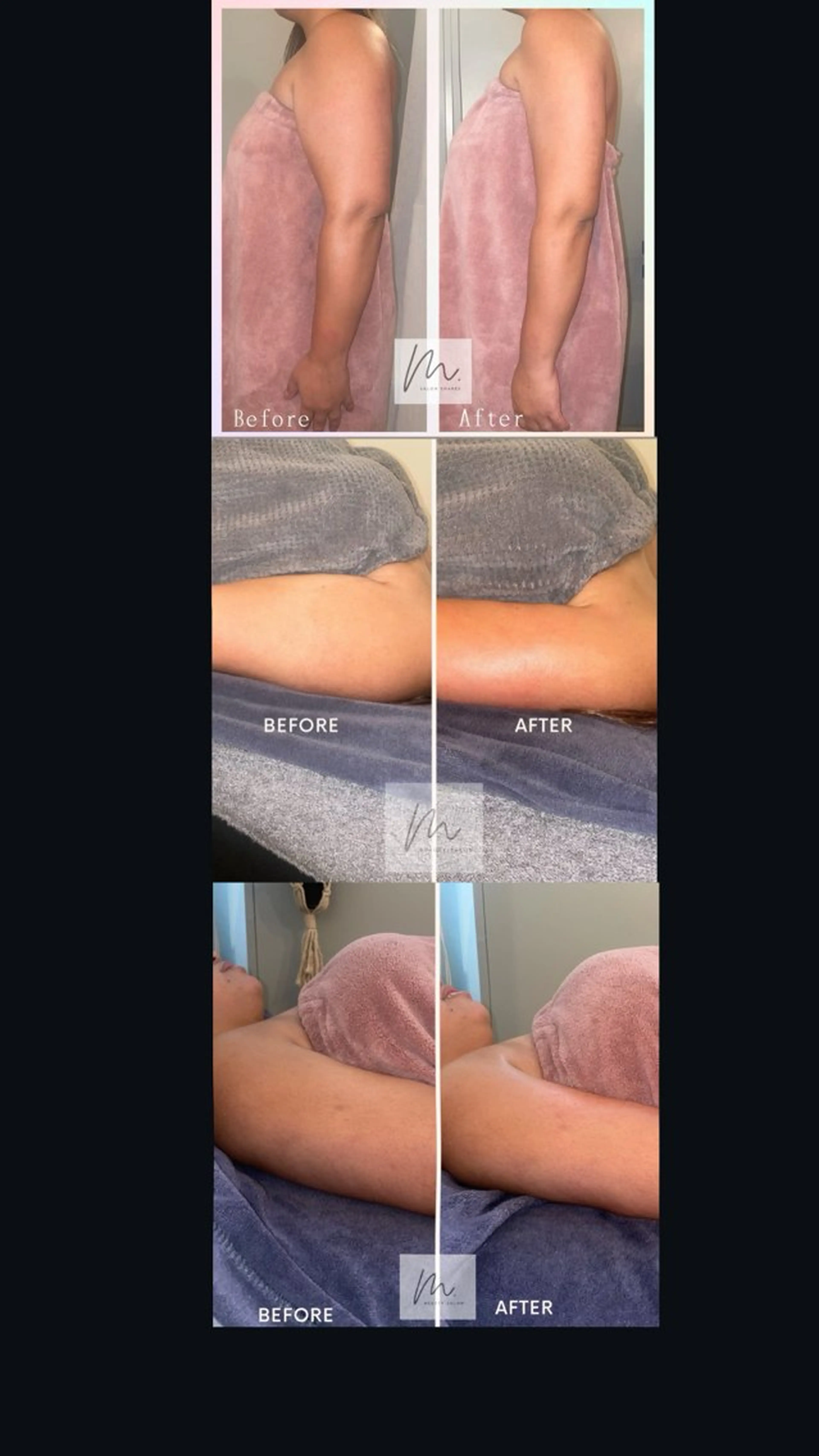 SHARES MADOKAのエステ・リラクイメージ