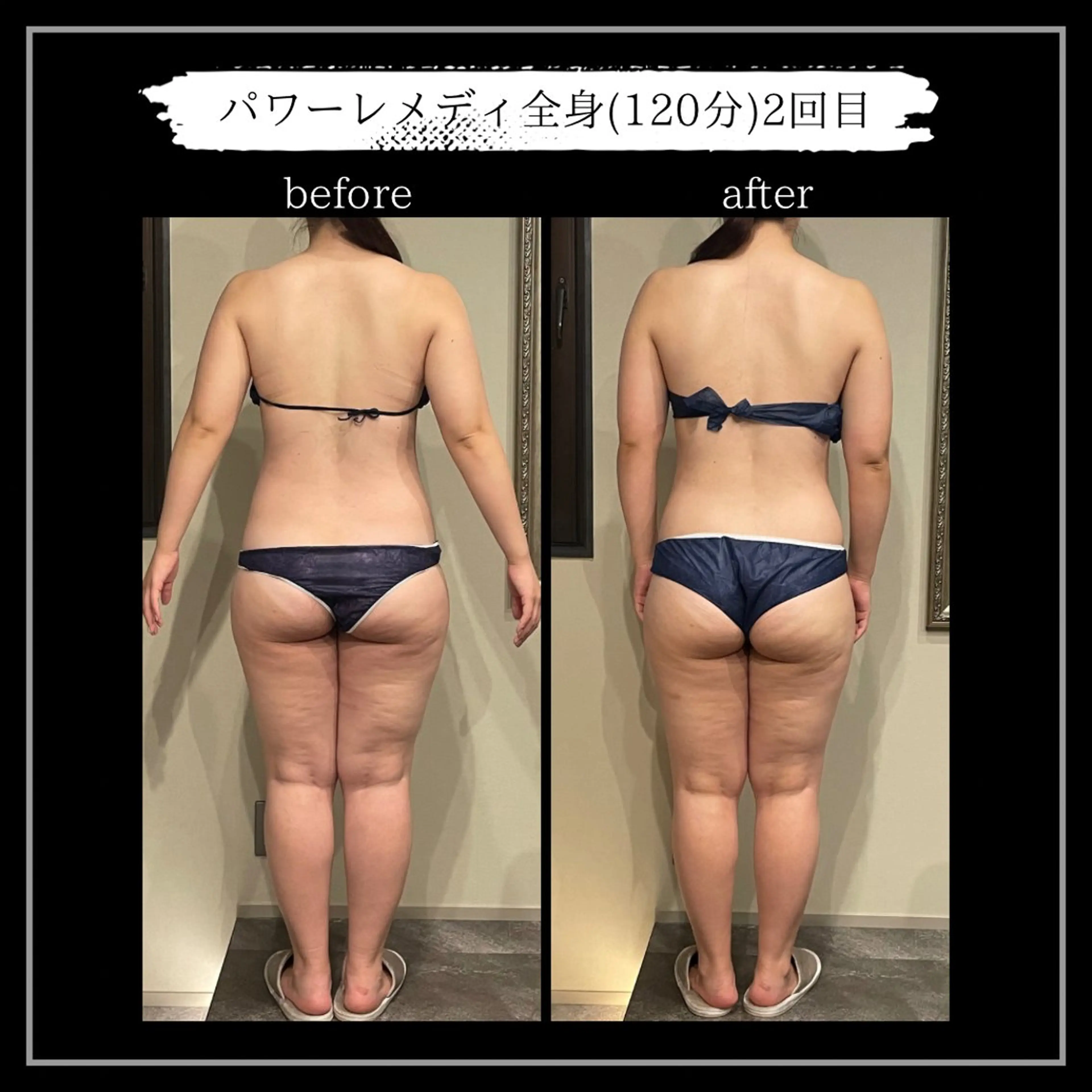 オフ:オン所属・オフ:オン 全身筋膜マッサージのエステ・リラクイメージ