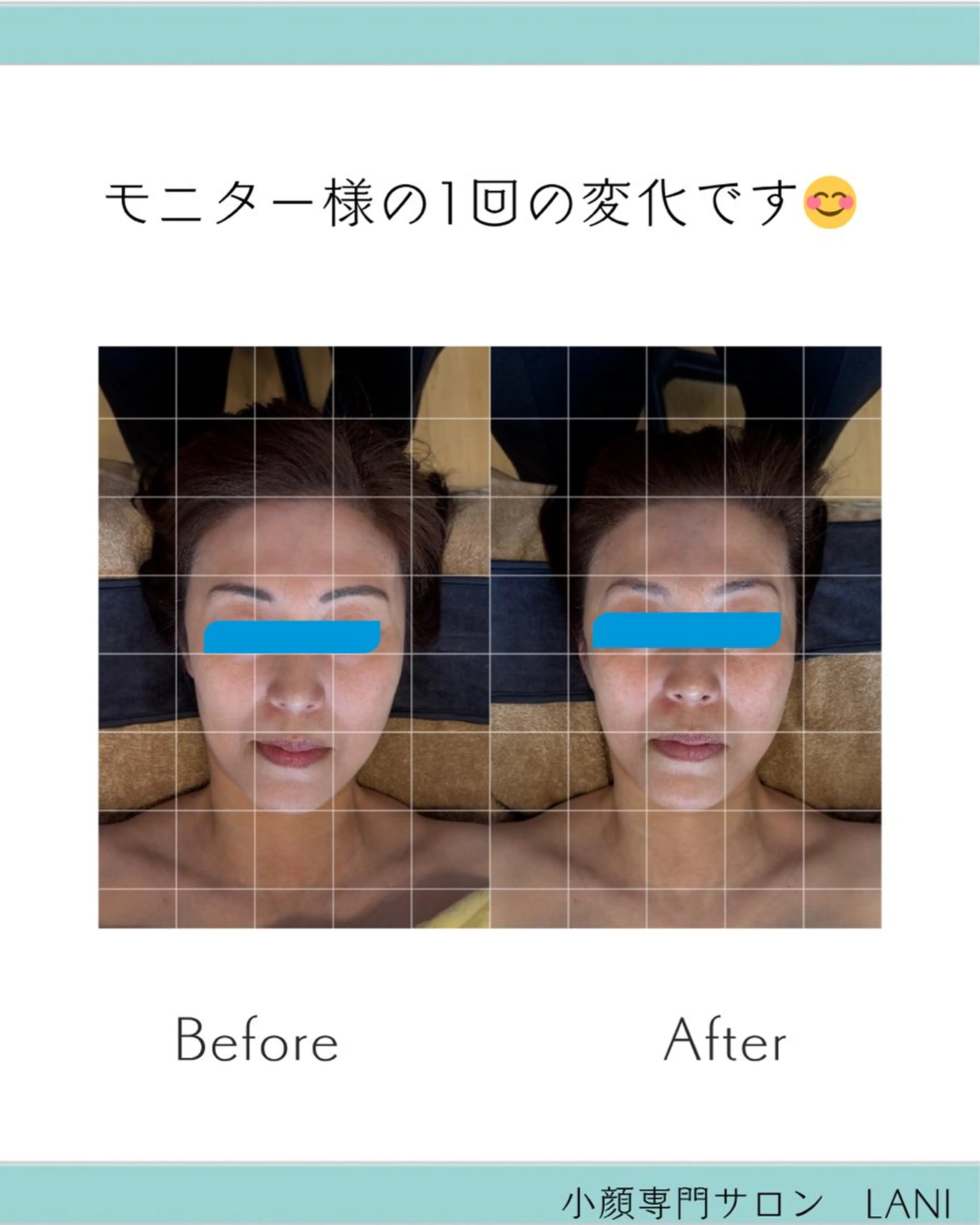 リラク LANI所属・小顔専門サロン MAIのエステ・リラクイメージ
