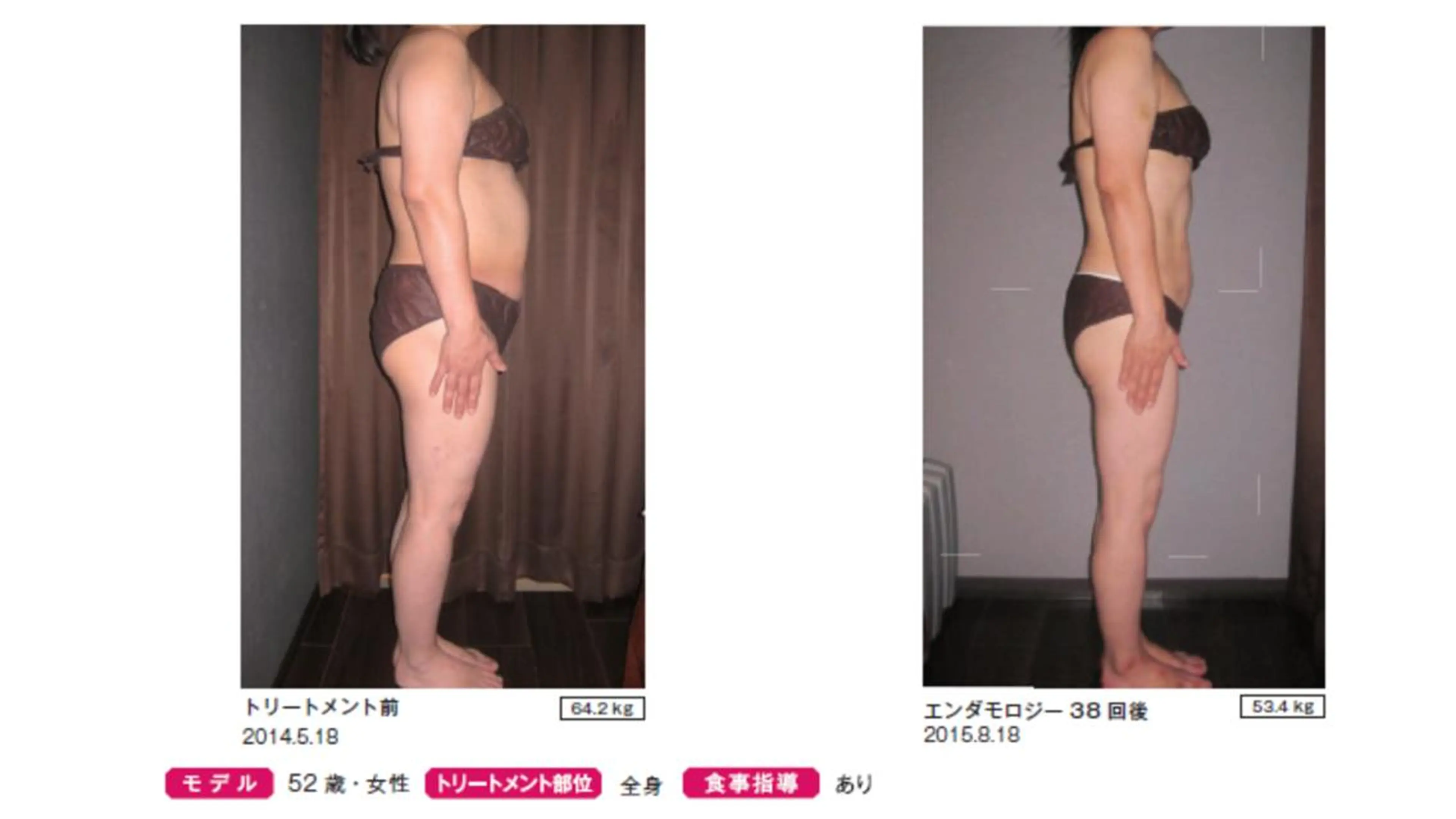 オレンジバナナ 新潟店のエステ・リラクイメージ