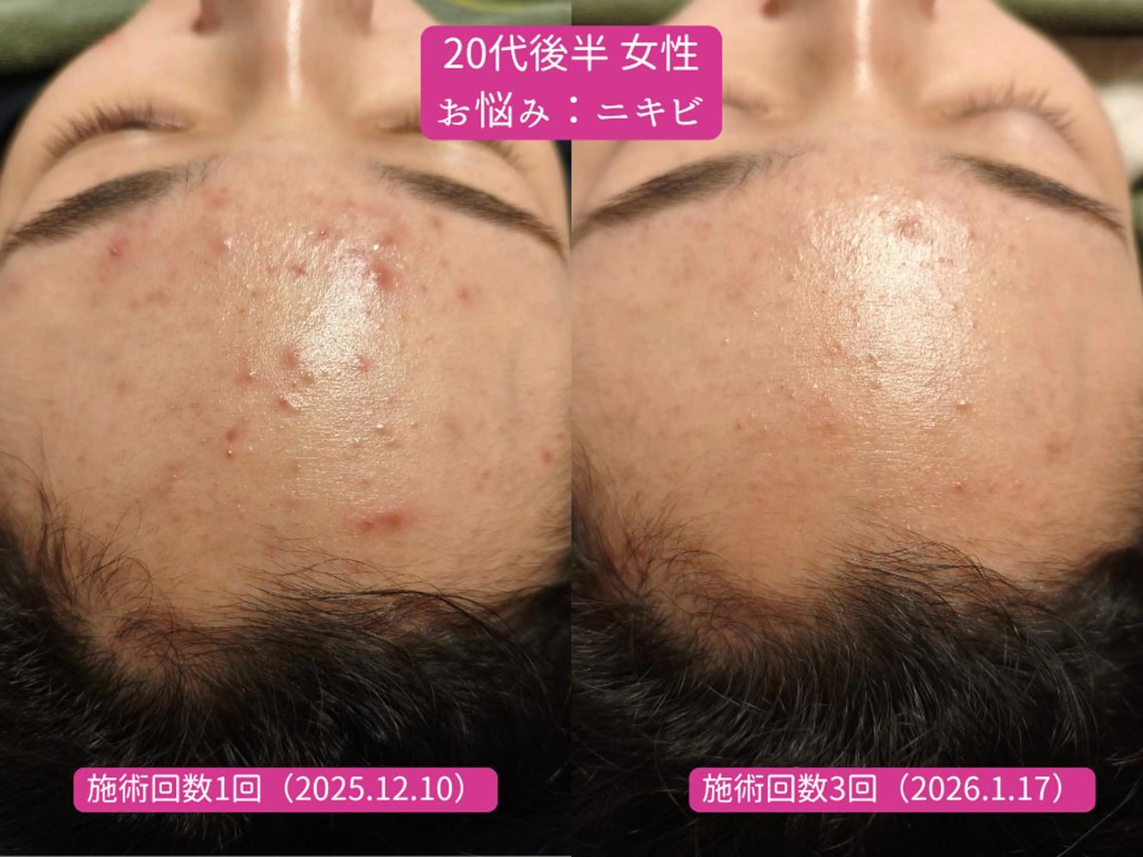 エステ リラク 美容とカラダの鍼灸 サロン やなけんのエステ・リラクイメージ