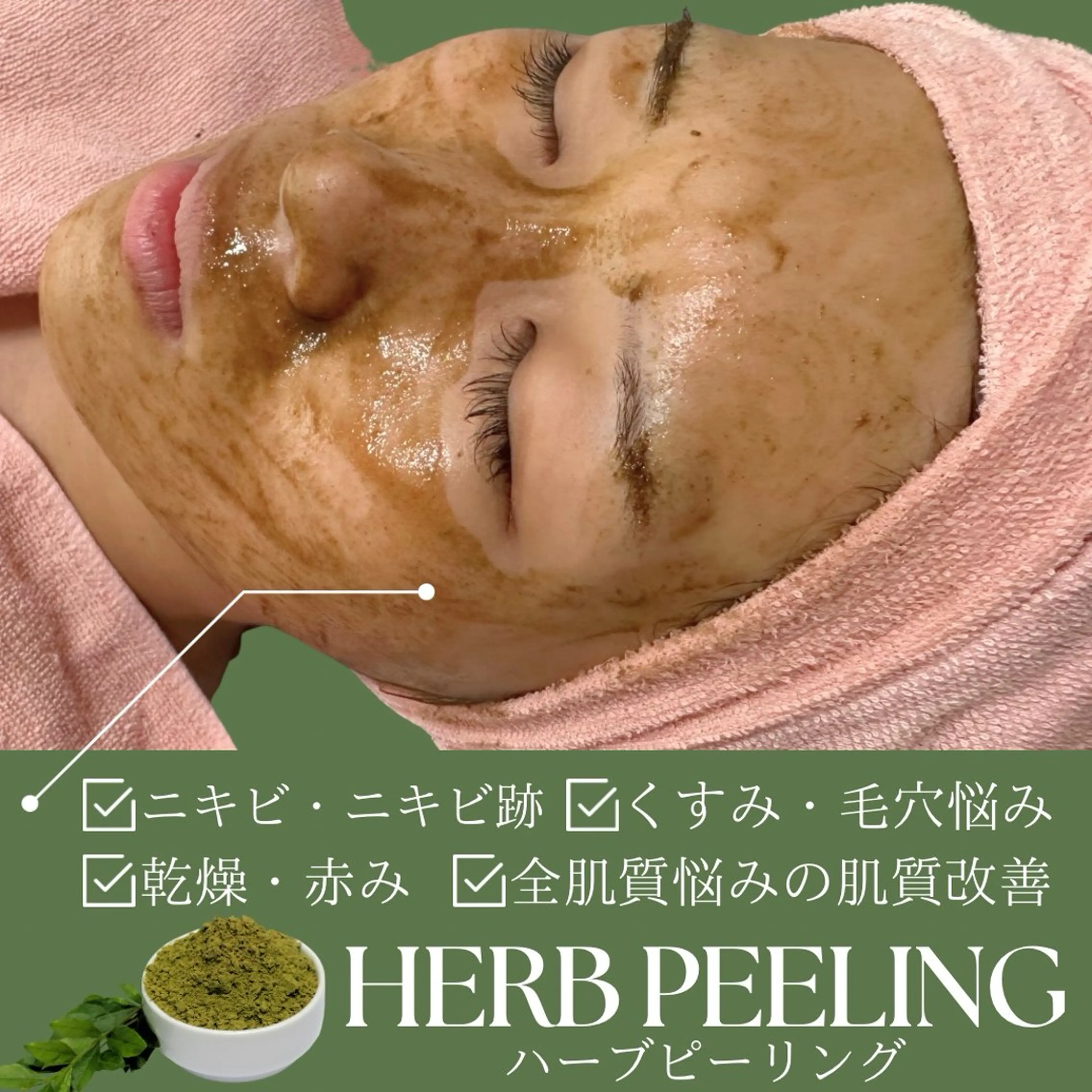 【明日26日1名様限定!】剥離なし肌質改善ハーブピーリングでツヤツヤ透明美肌へ🌿✨【ニキビケア/赤み/開き毛穴に◎】の写真