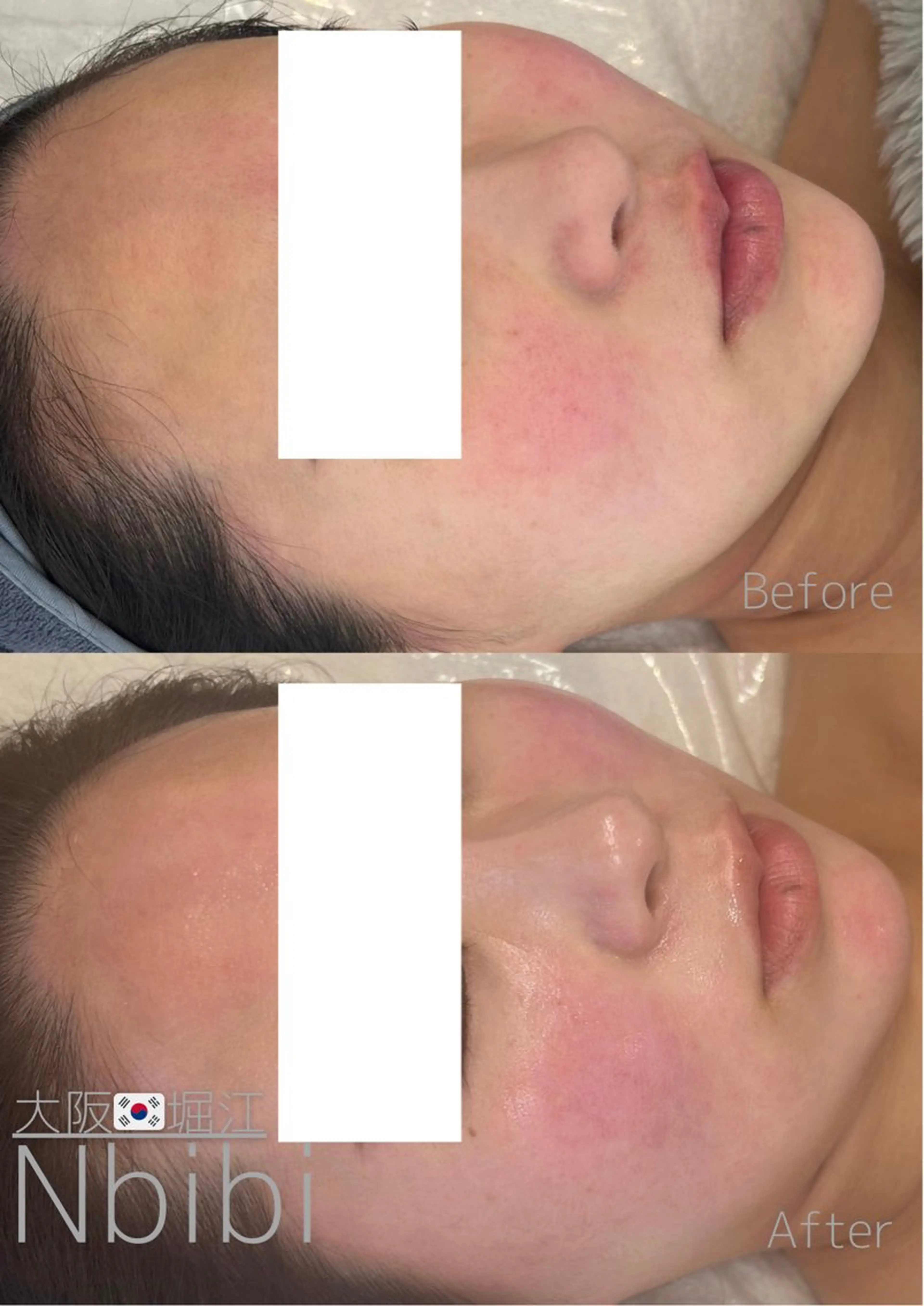 エステ 韓国🇰🇷価格 サロン_Nbibiのエステ・リラクイメージ