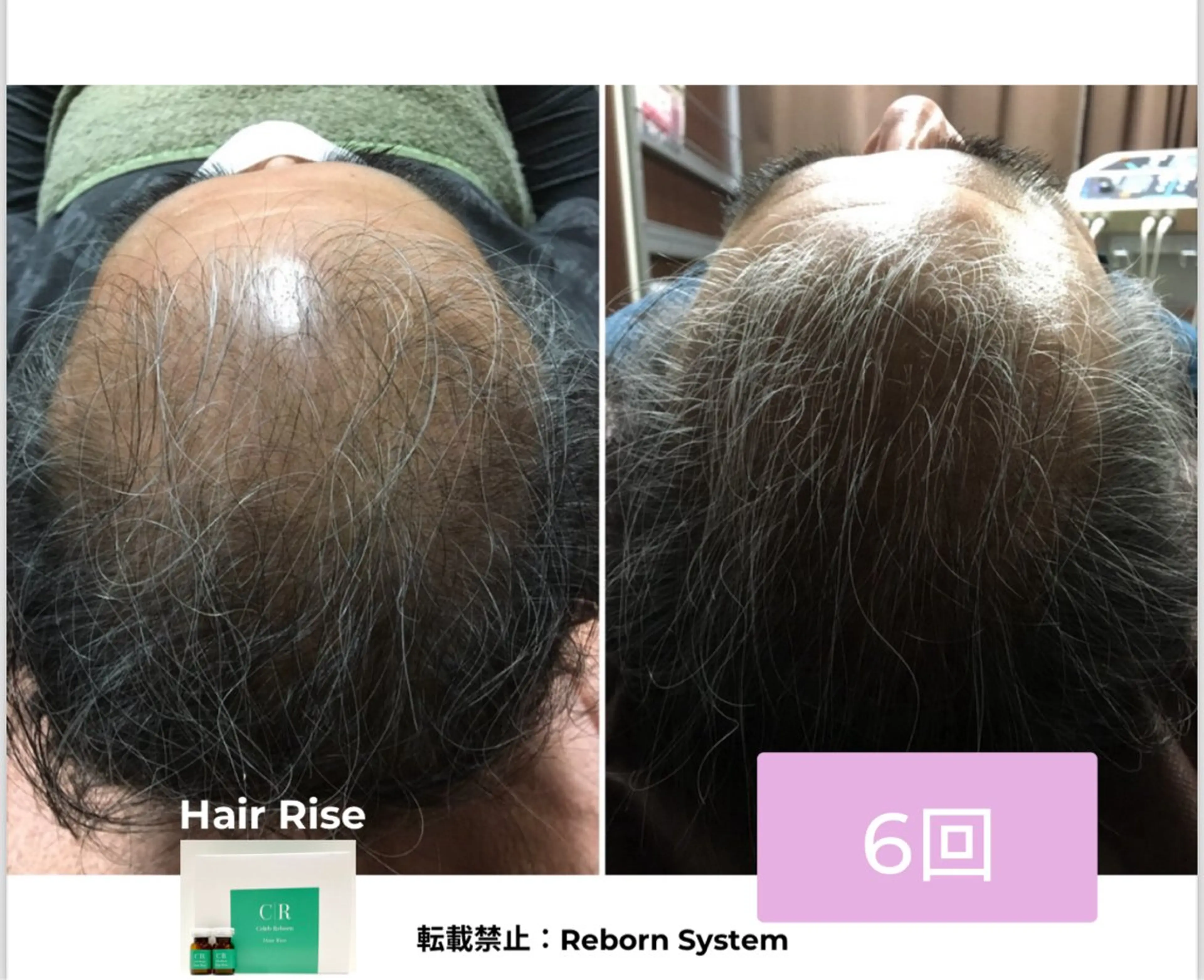 【福岡市西区 エステ】 GRANVIR(グランヴィール)所属・GRANVIR グランヴィールのエステ・リラクイメージ