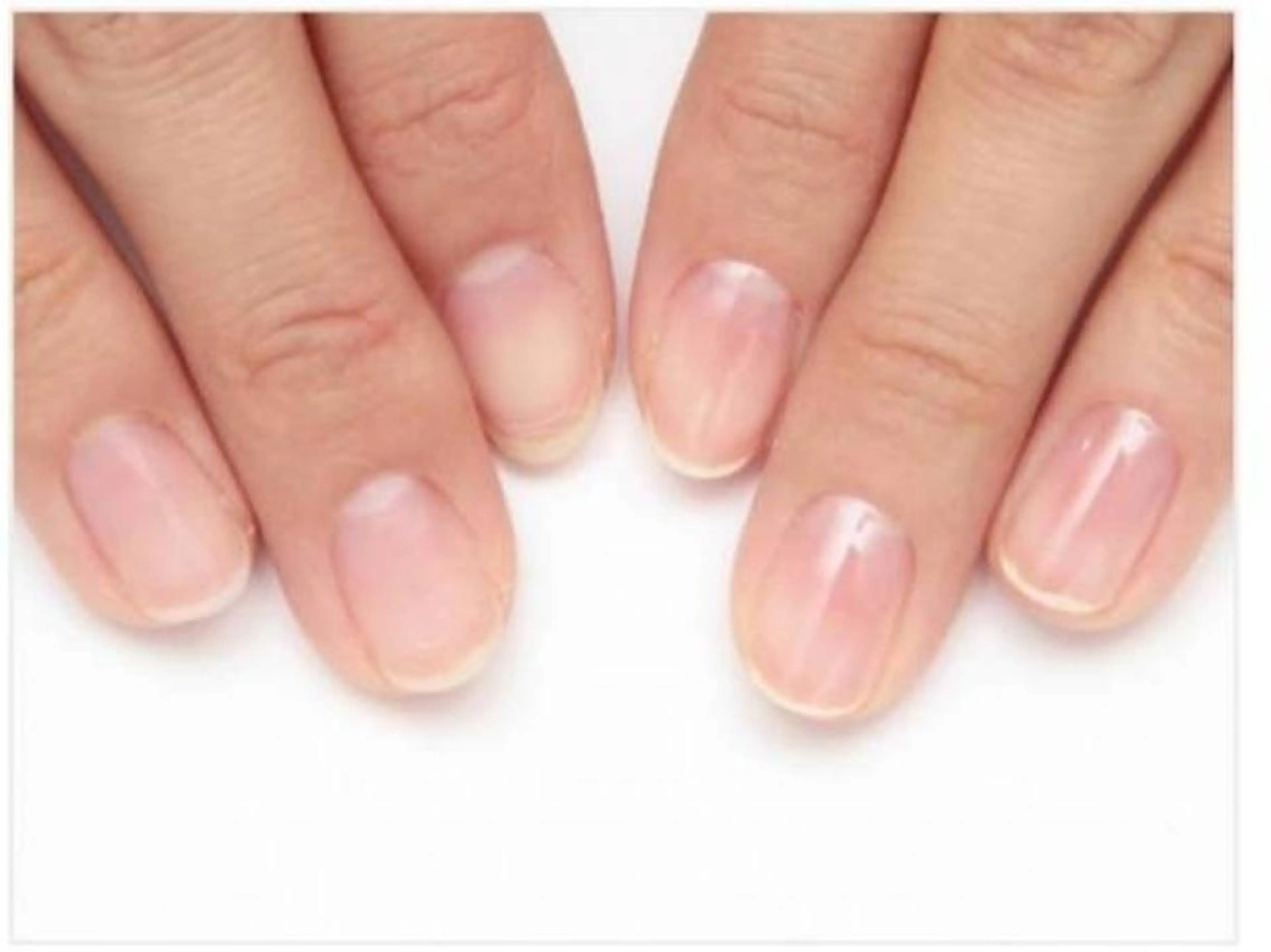 オフケアの写真