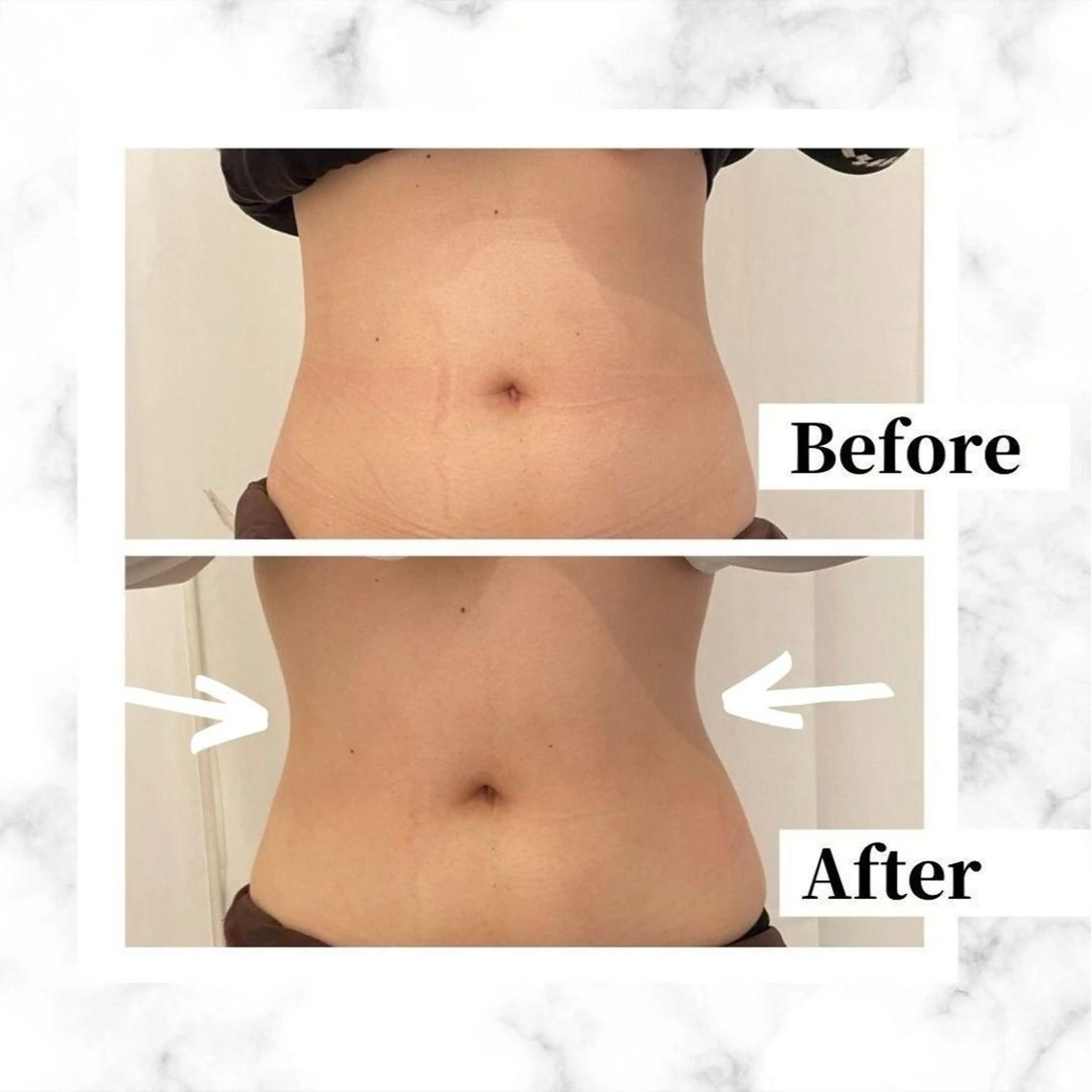 エステ リラク 12Dハイフ💗 最強小顔のエステ・リラクイメージ