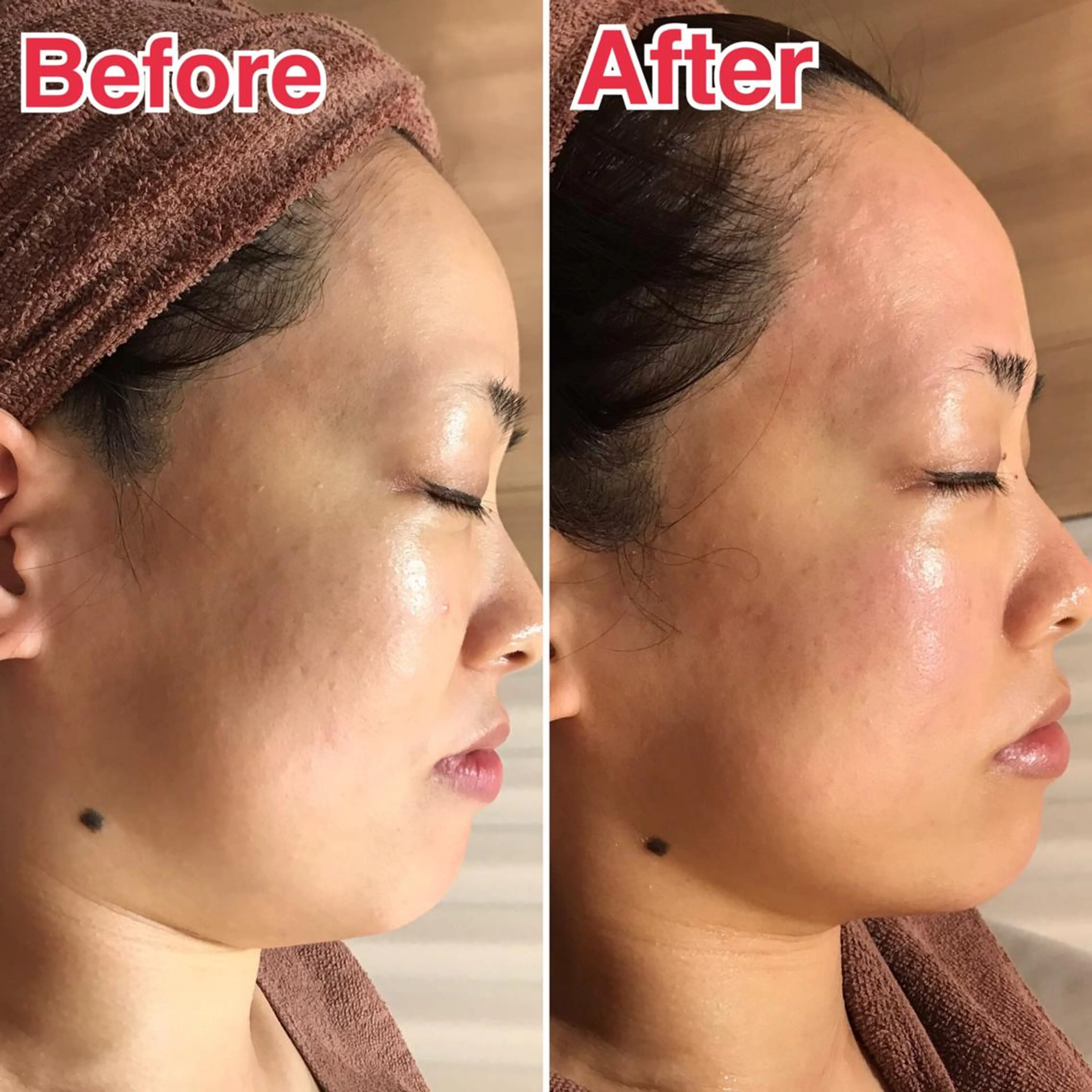 🗻エステティック RAYVIS藤🐈のエステ・リラクイメージ