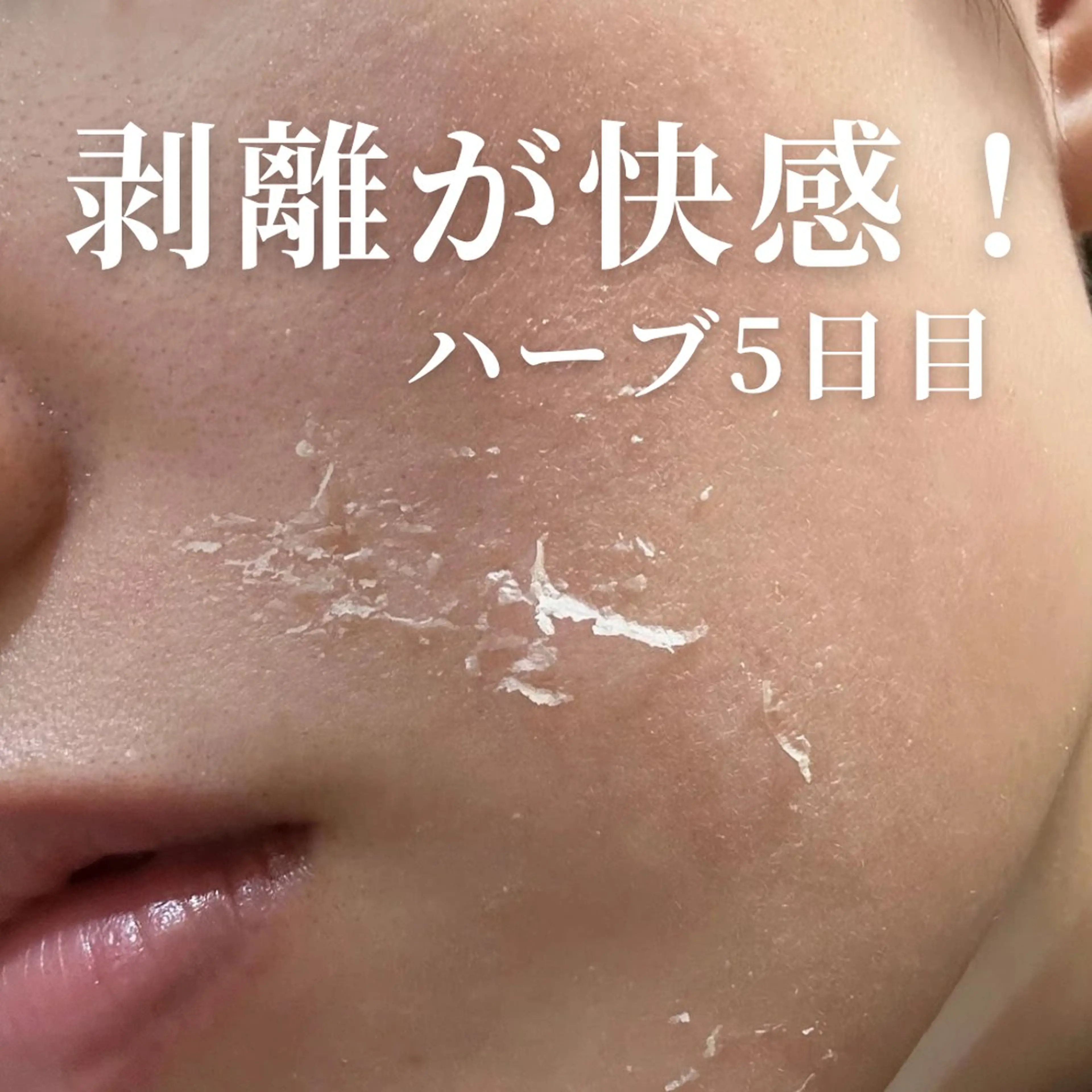 エステ clé skin 🌿ハーブピーリングのエステ・リラクイメージ