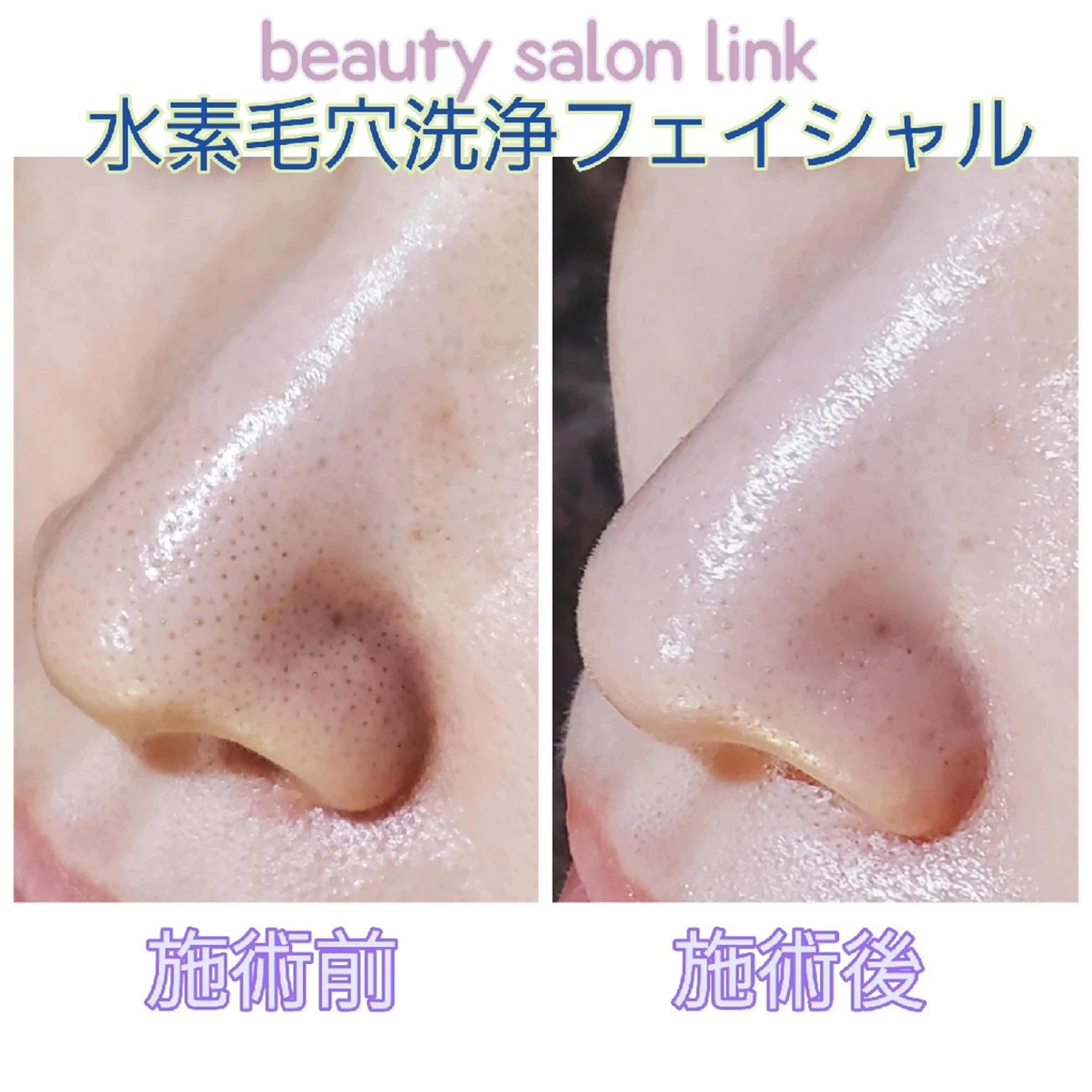 beauty salon  link所属・水素エステと美容脱毛 salon Linkのエステ・リラクイメージ