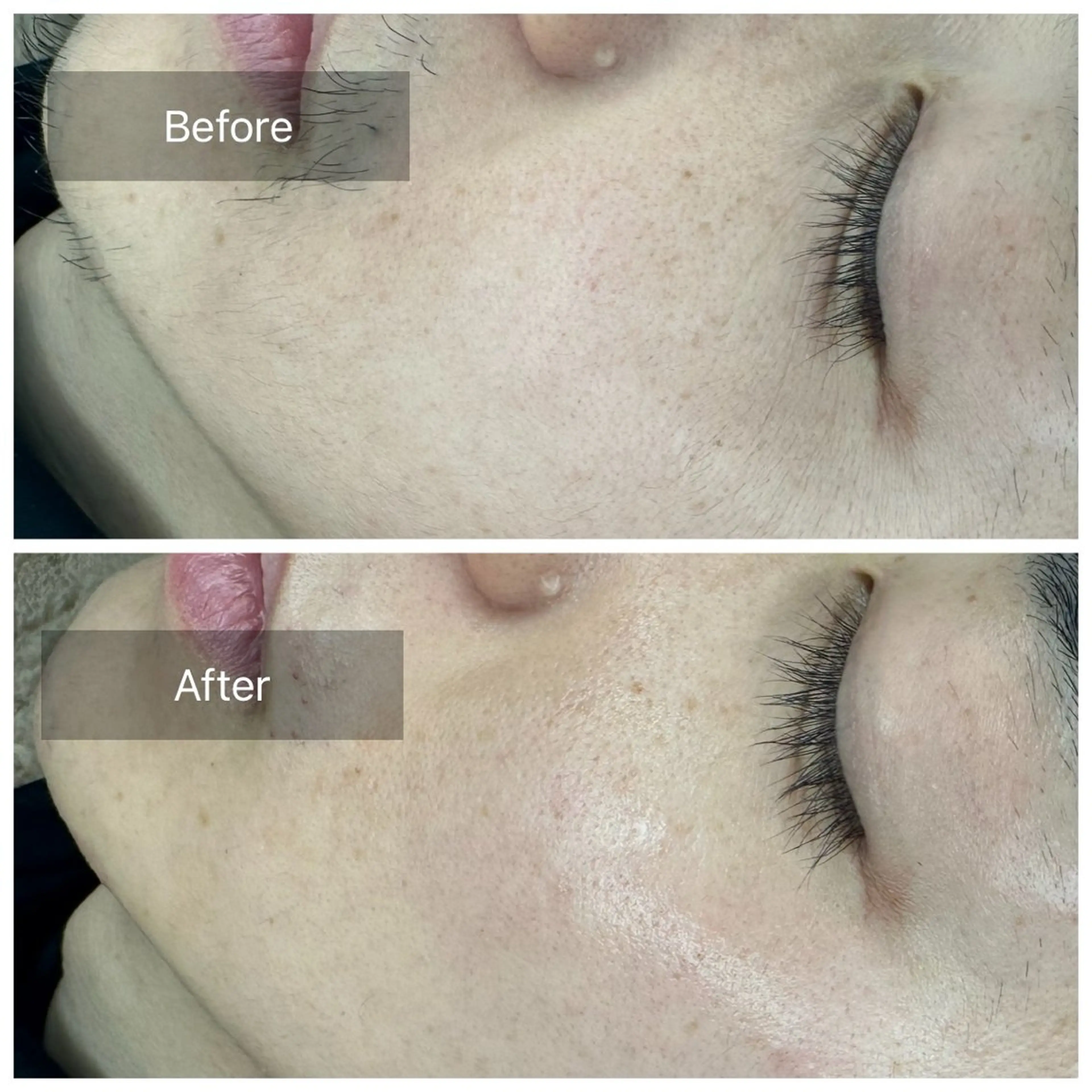 《男性》清潔感UP！フェイスワックス🫧(シートパック付／高保湿モデリングパック変更可)１度で効果を感じられます🥚✨の写真