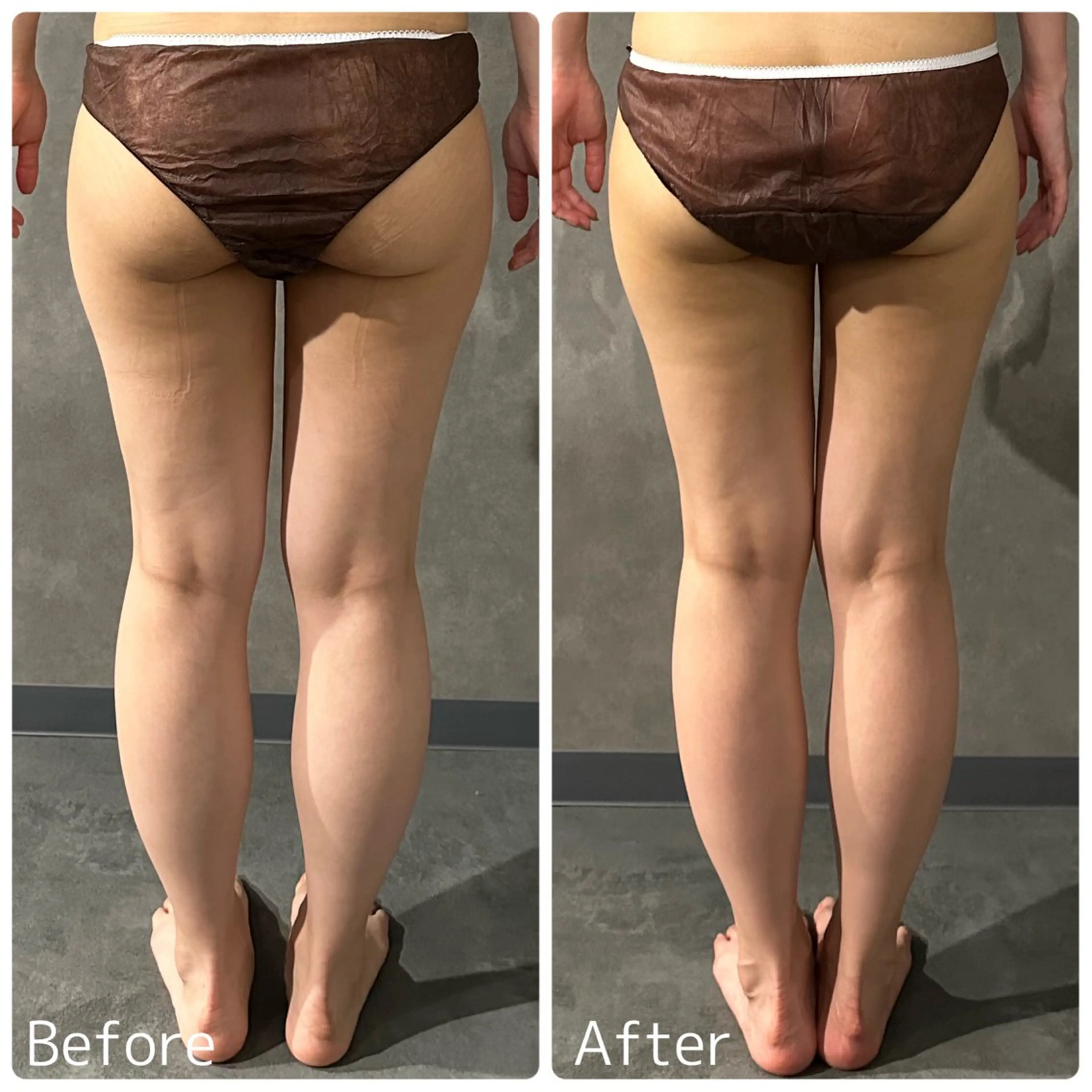 エステ Soleil Belle所属・ソレイユベル Hinaのエステ・リラクイメージ