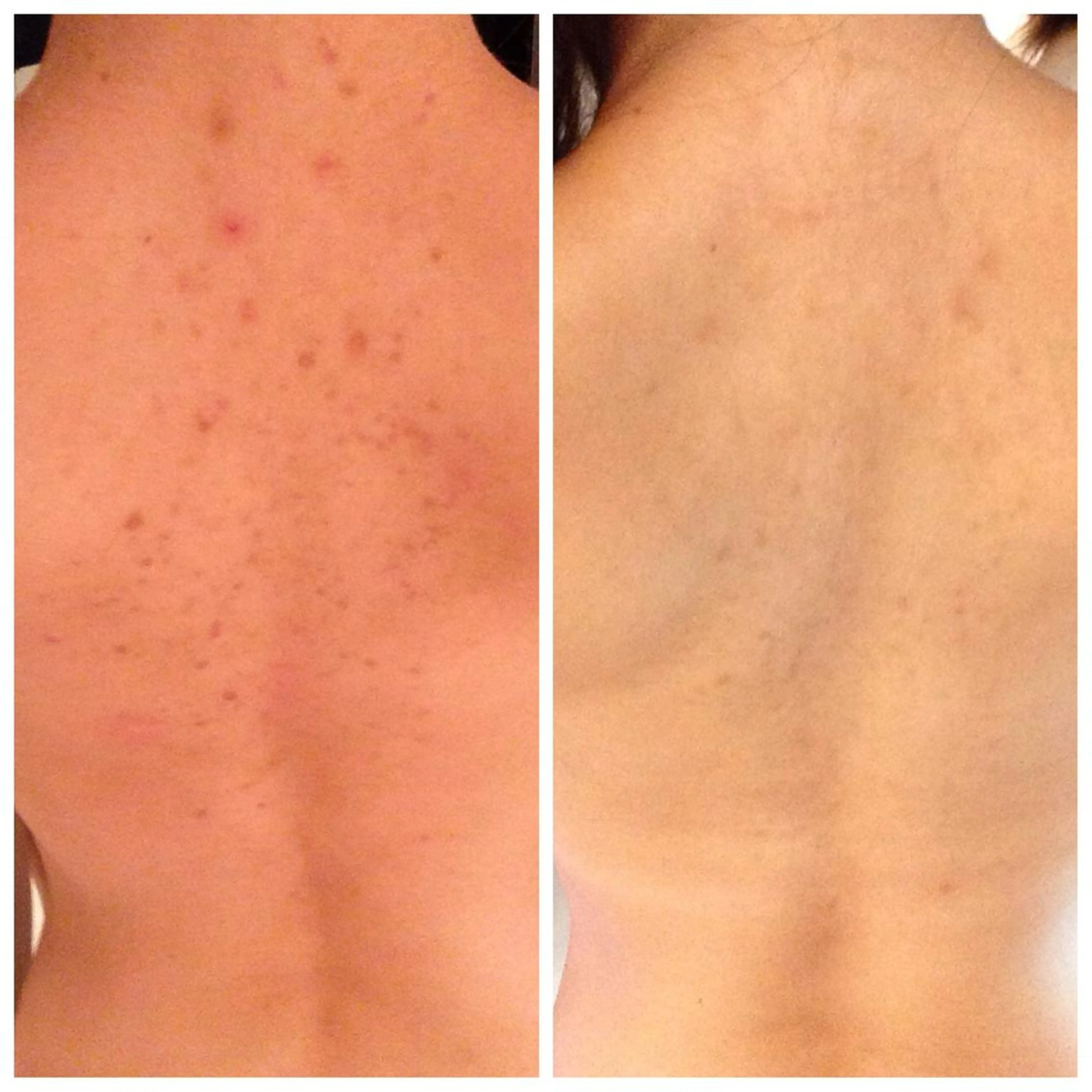 エステ フェイシャル専門 肌質改善/プランスのエステ・リラクイメージ