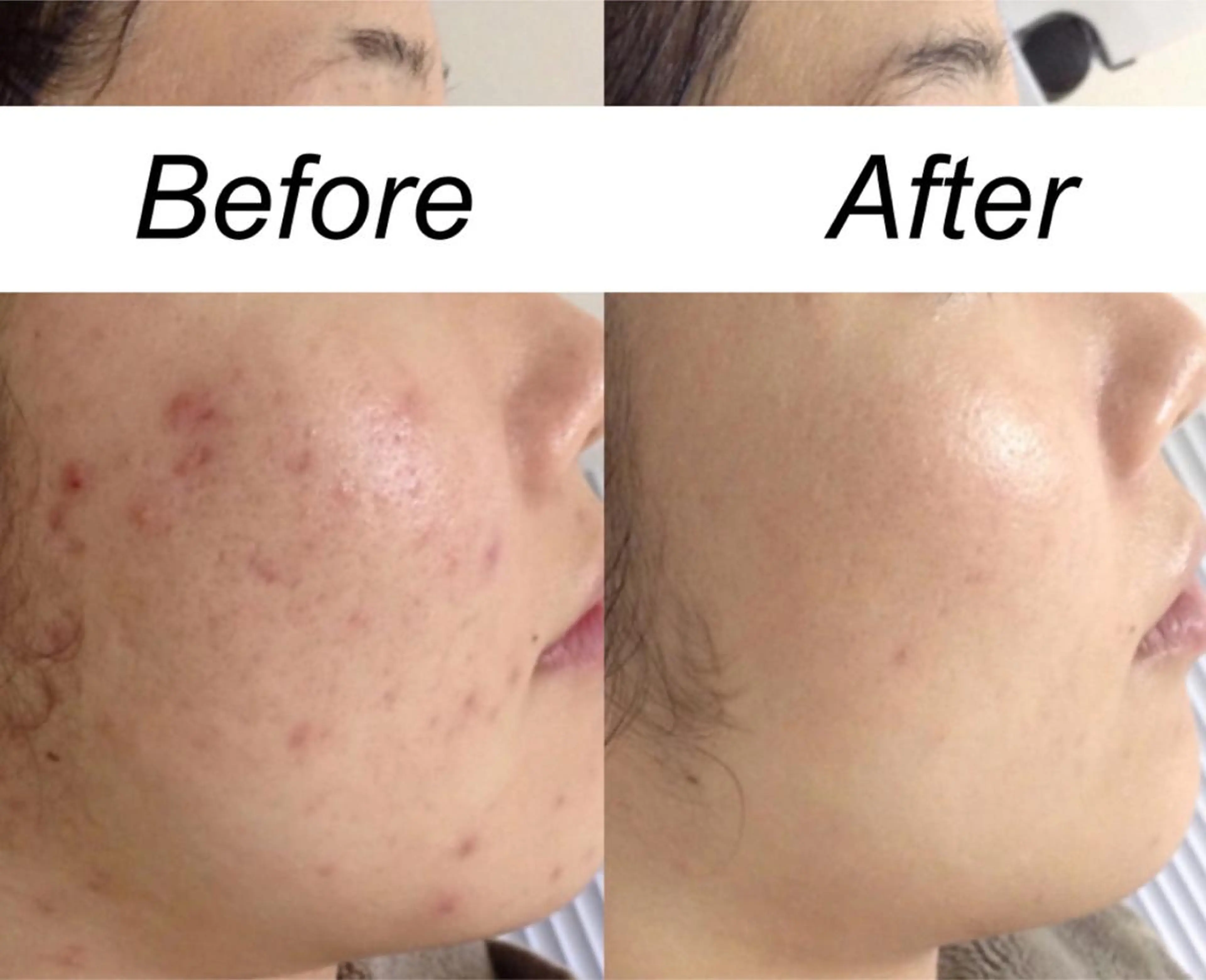 ミディアム カラー パーマ ヘアアレンジ メンズ キッズ ネイル マツエク・マツパ エステ リラク 都度払い肌質改善 &脱毛Blancheのエステ・リラクイメージ