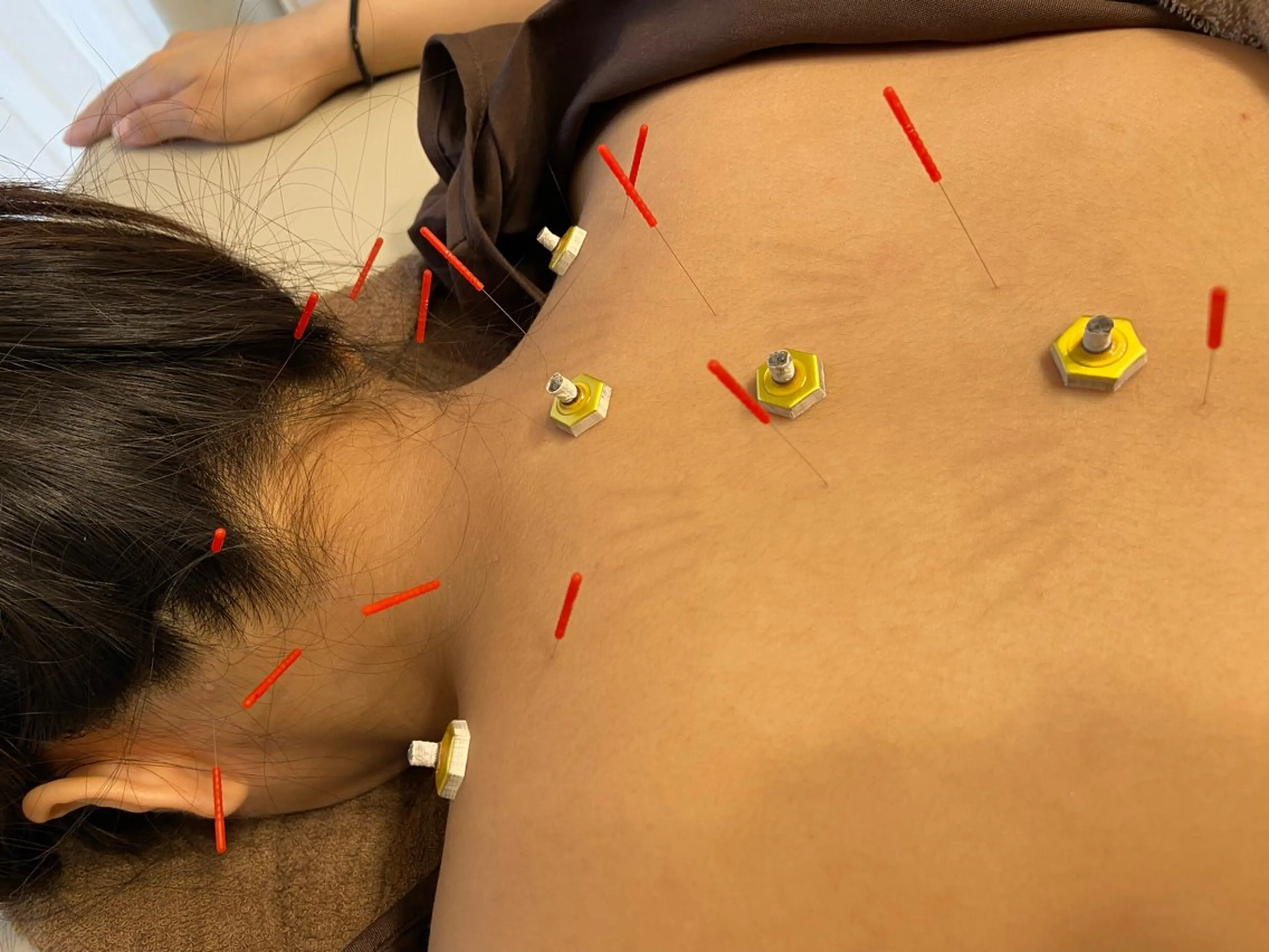 肩こりケアの写真