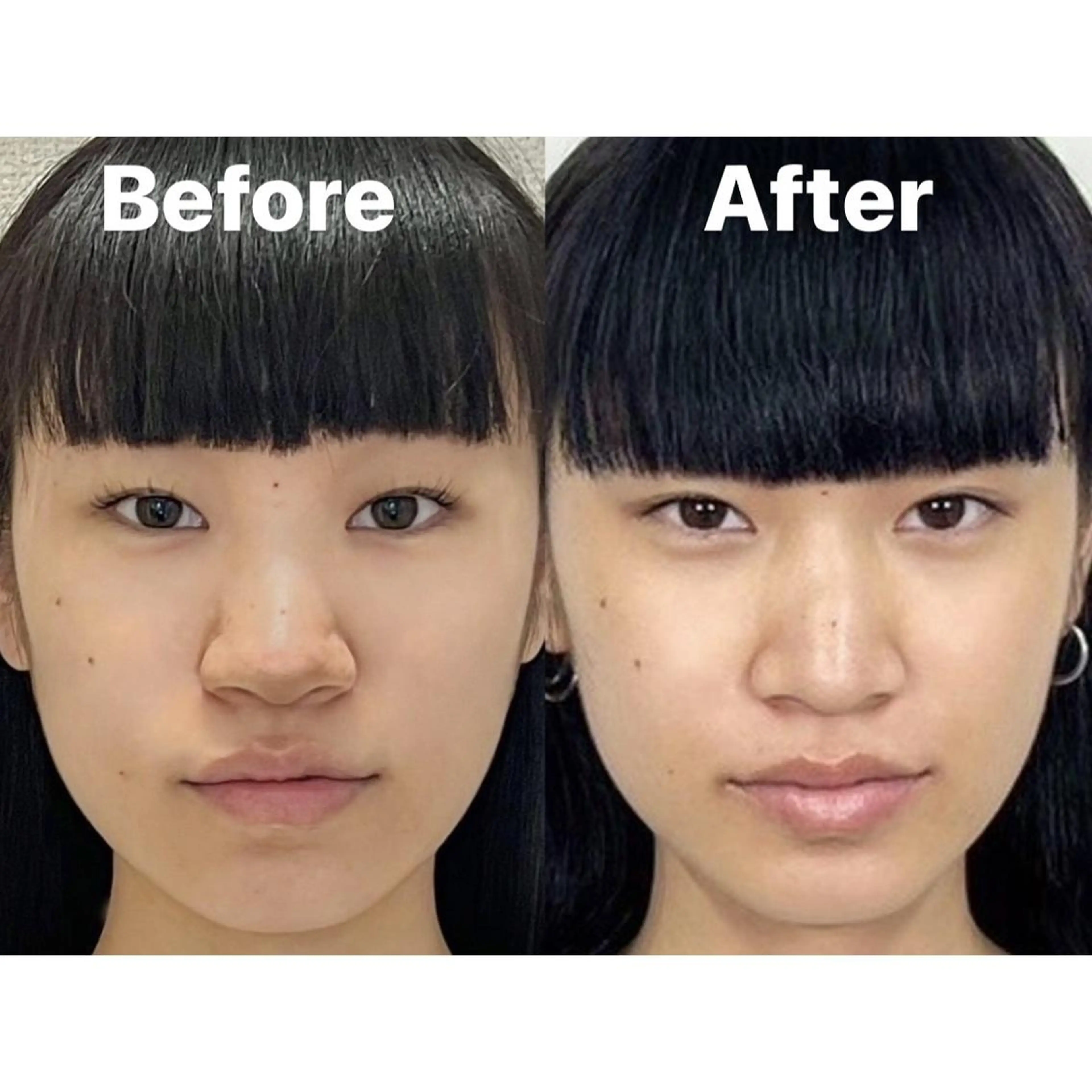 エステ リラク 隆鼻矯正専門店ラプリ 古越のエステ・リラクイメージ