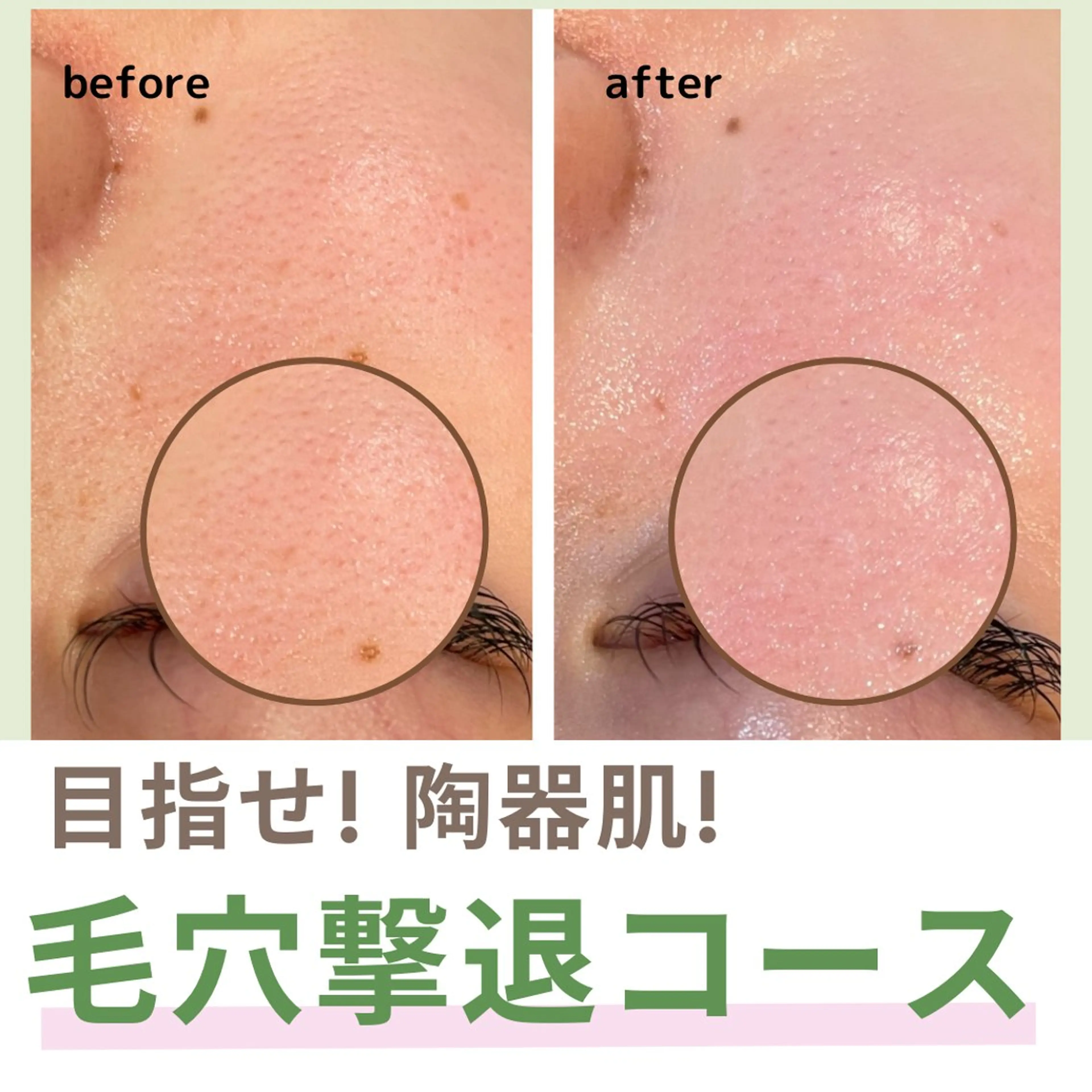 leolo武蔵浦和 肌質改善＆脱毛のエステ・リラクイメージ