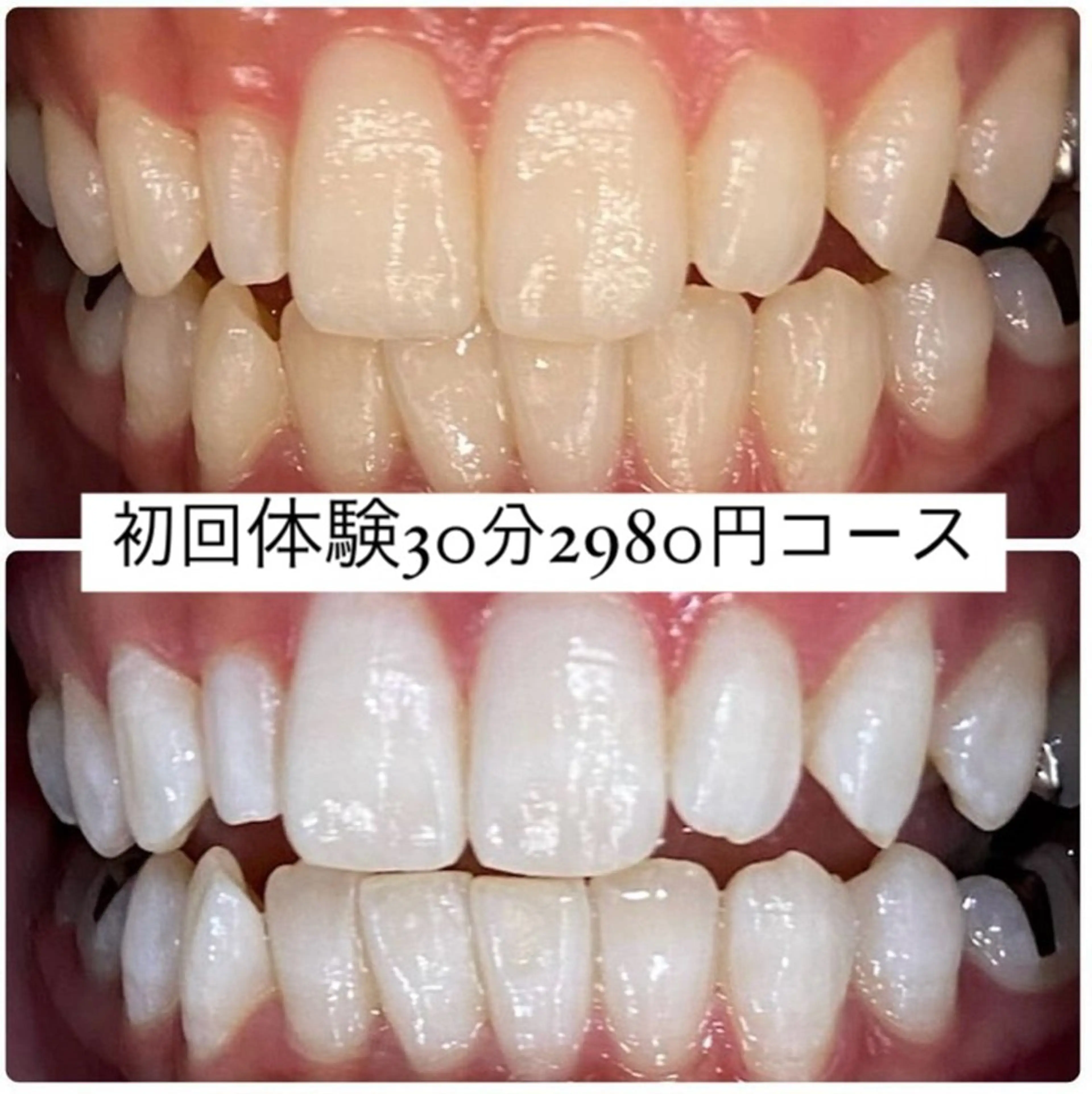 PLATINUM Beauty 横浜店所属・ホワイトニングルーム 横浜店のその他イメージ