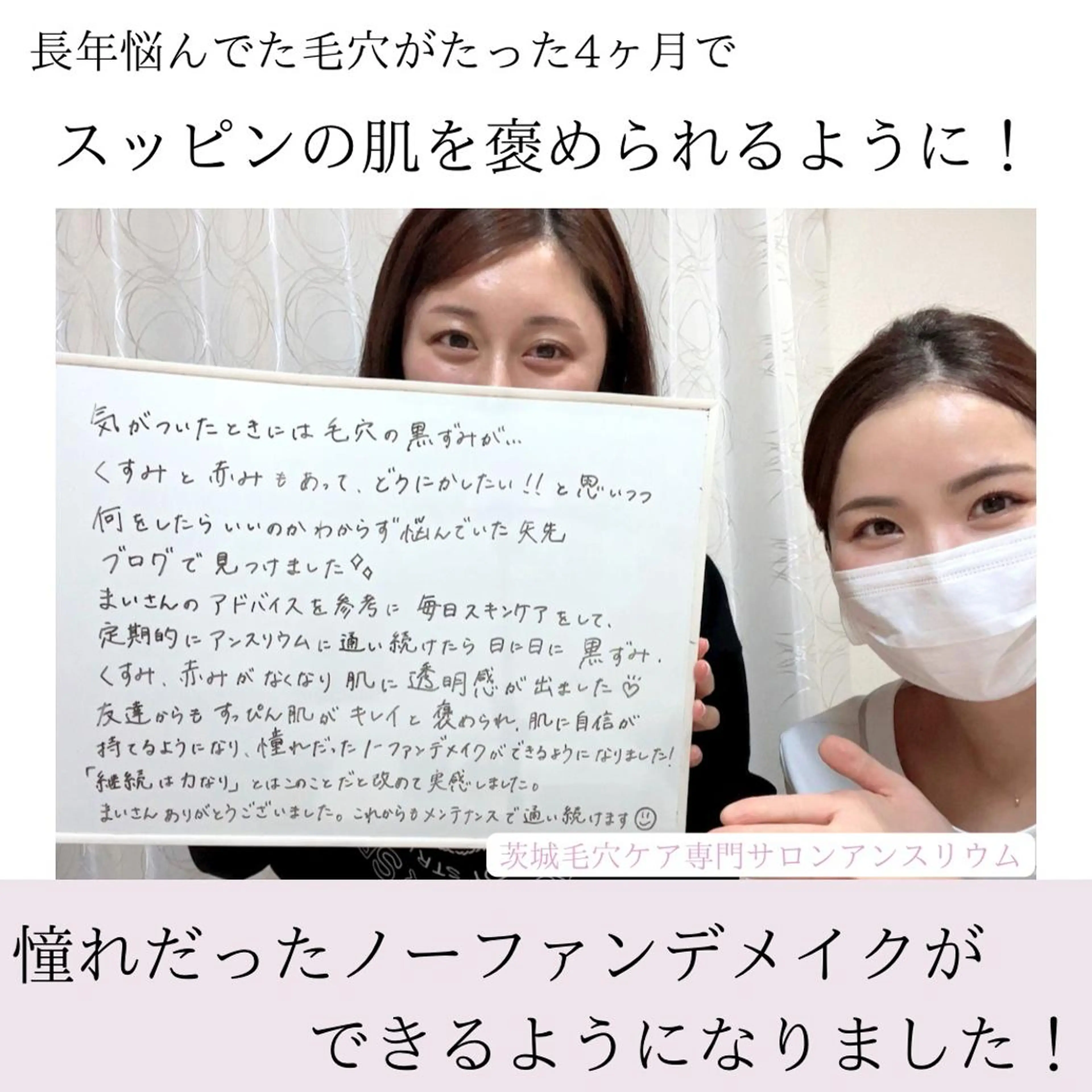 毛穴ケア専門サロンアンスリウム所属・茨城土浦 つくば毛穴 ケア専門サロンのエステ・リラクイメージ