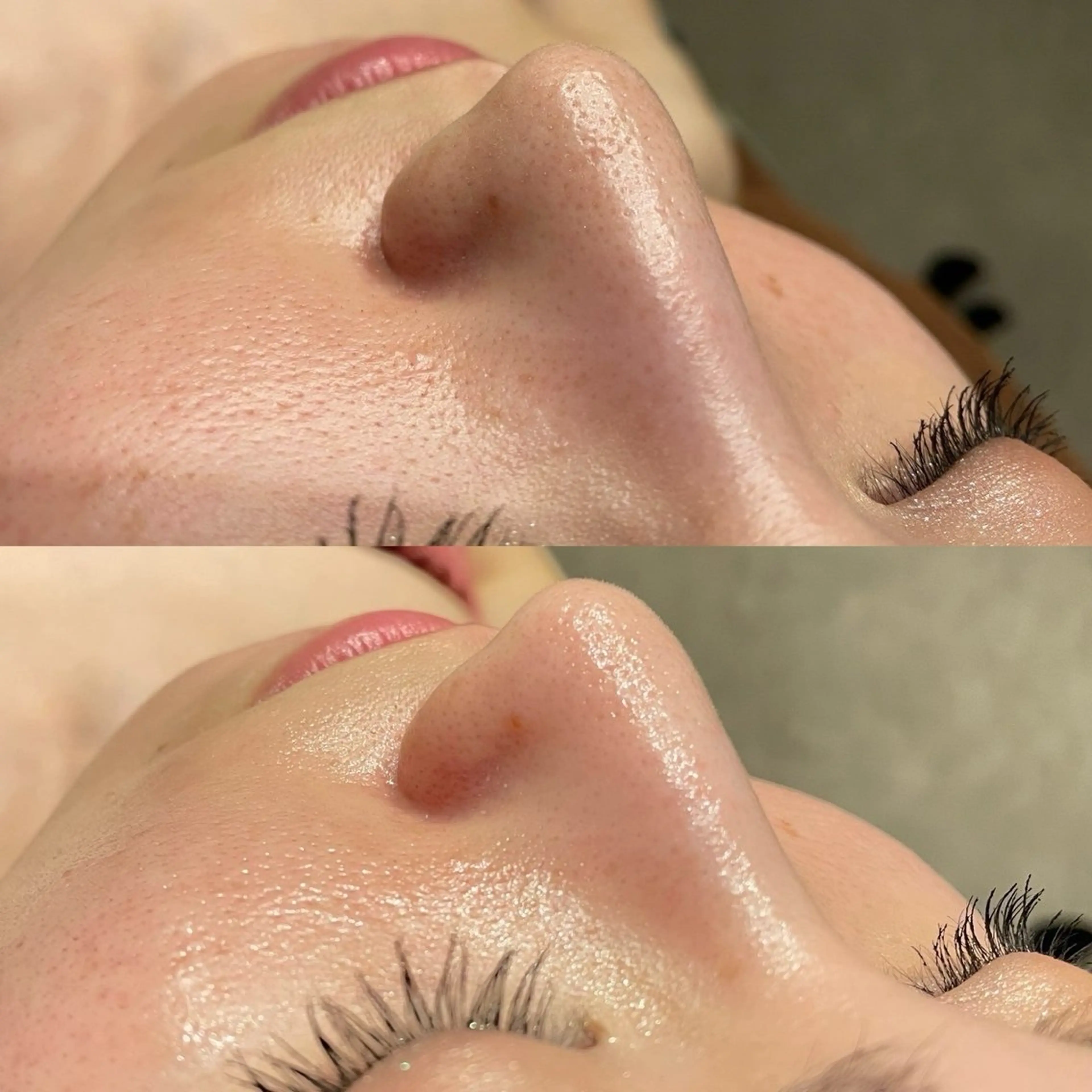 肌管理専門店Whitelabo堺東店所属・おだ あみのエステ・リラクイメージ