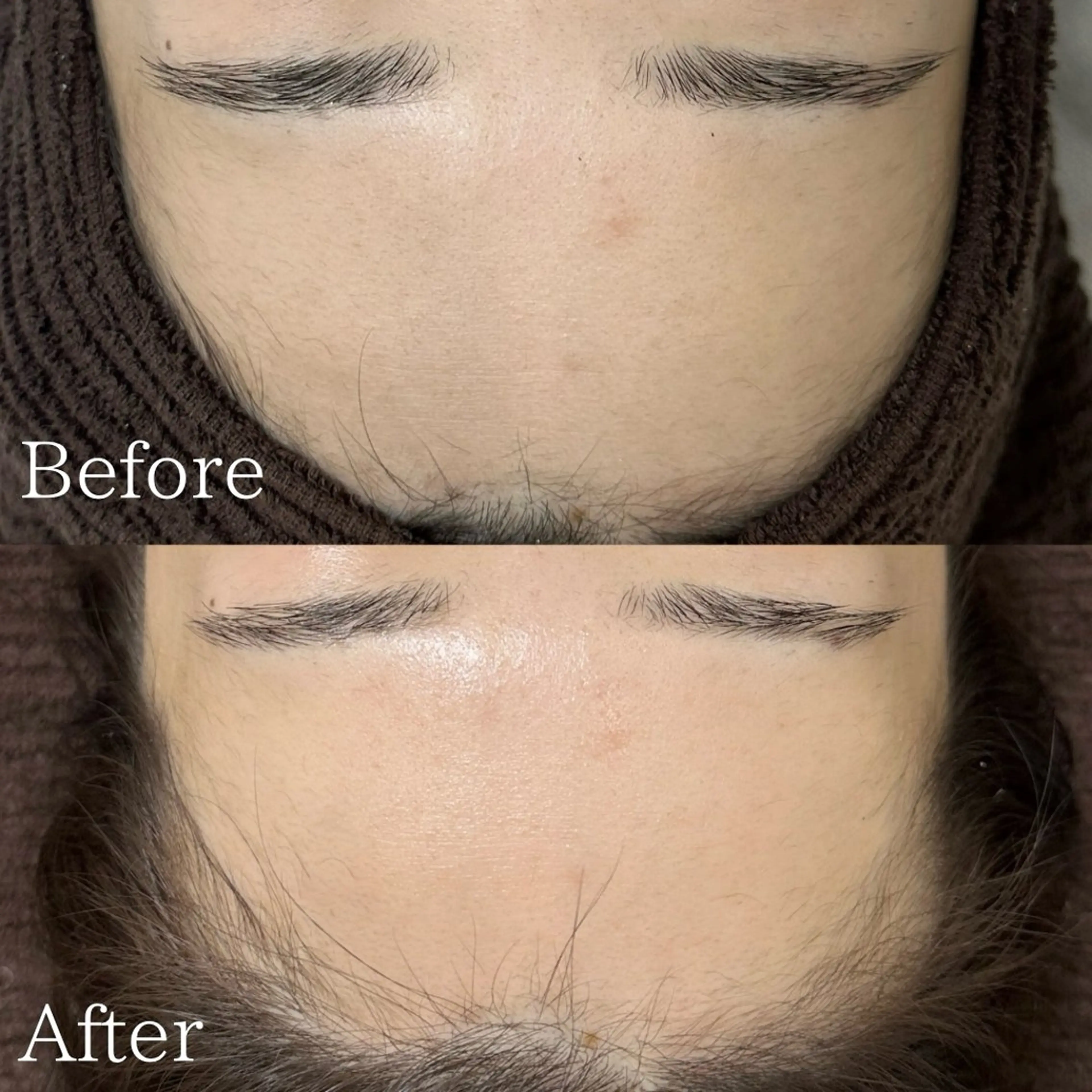 エステ lafleur Yurinaのエステ・リラクイメージ