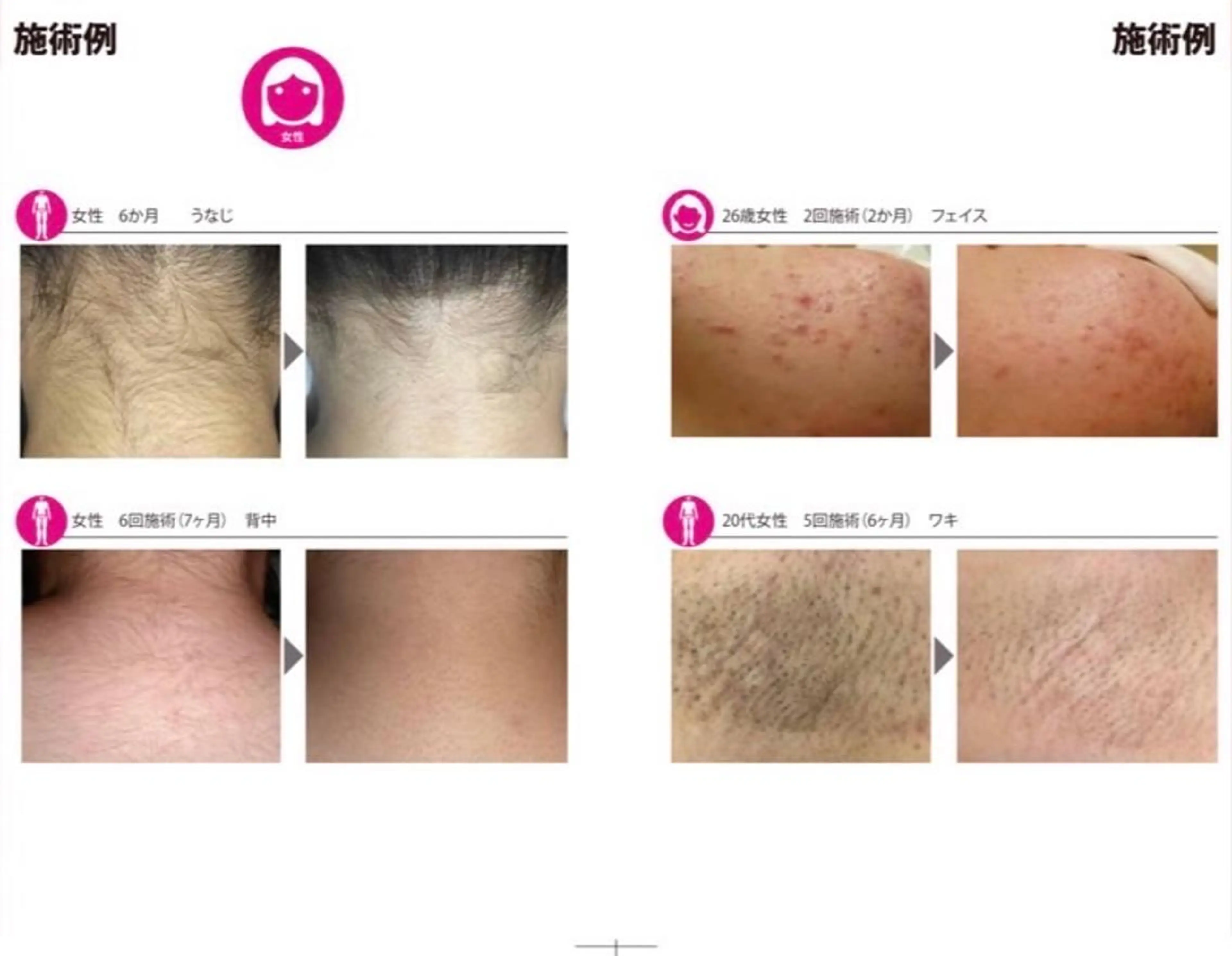 眠りの森/脱毛眉毛/ マッサージ/RINAのエステ・リラクイメージ