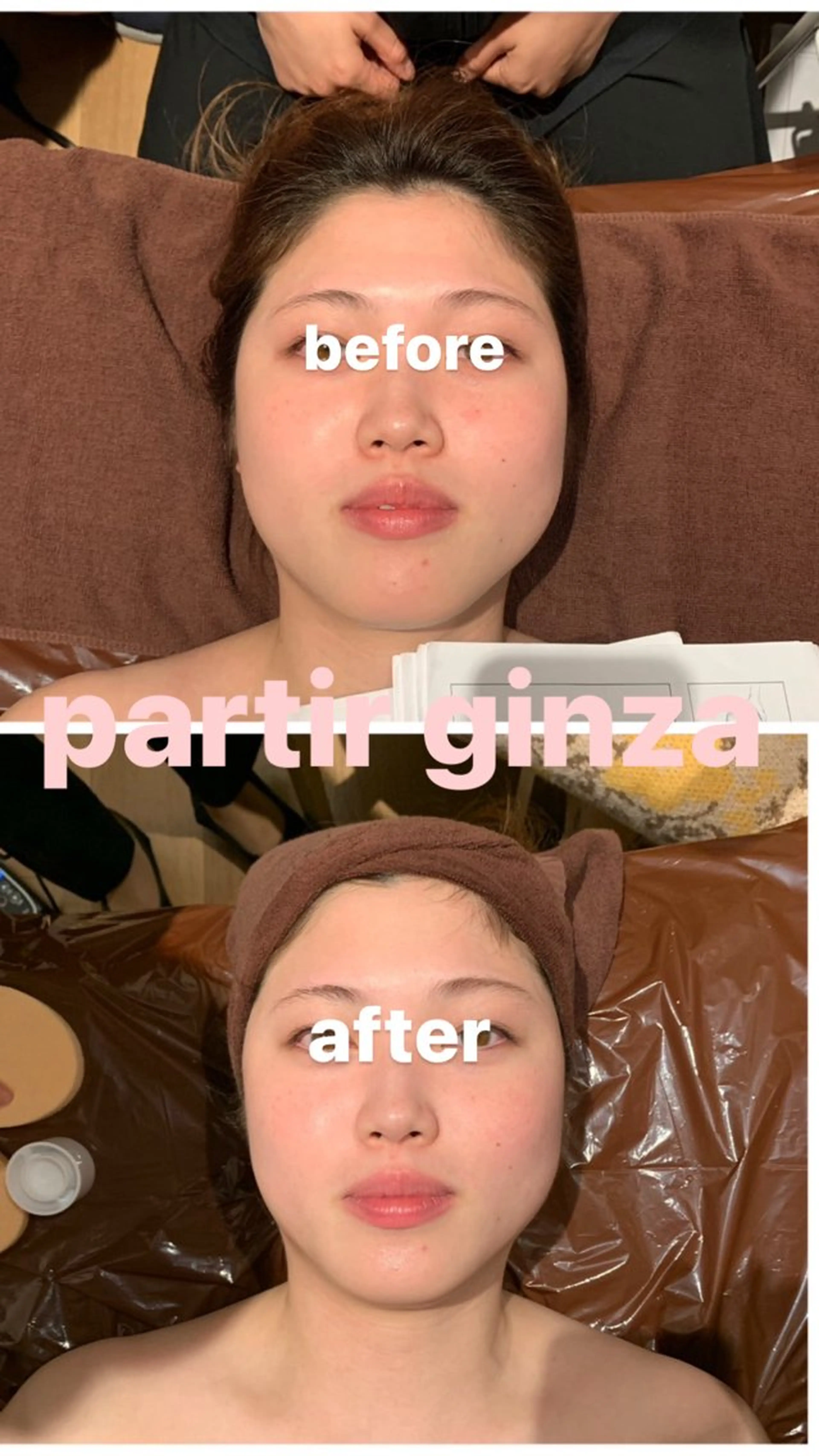 【韓国美肌】韓国式肌再生造顔メゾット✨とにかくお肌をツルツルにしたい！小顔になりたい！肌組織の深部から根本ケア✨の写真