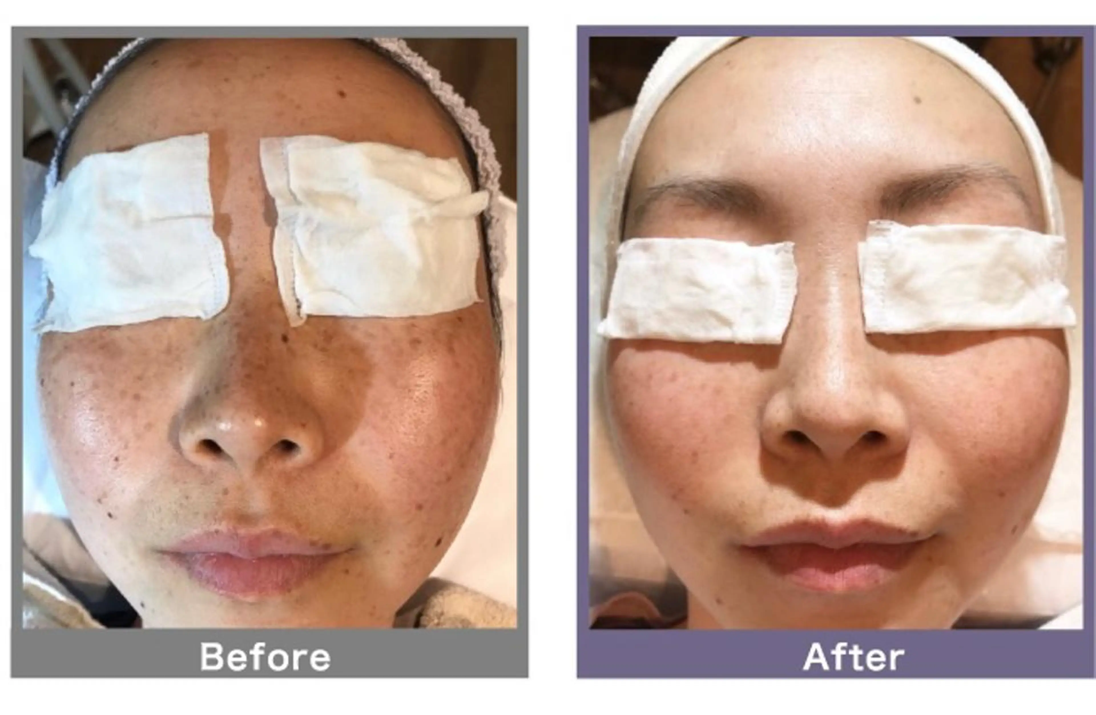 rasera所属・rasera コラボ予約のネイルデザイン