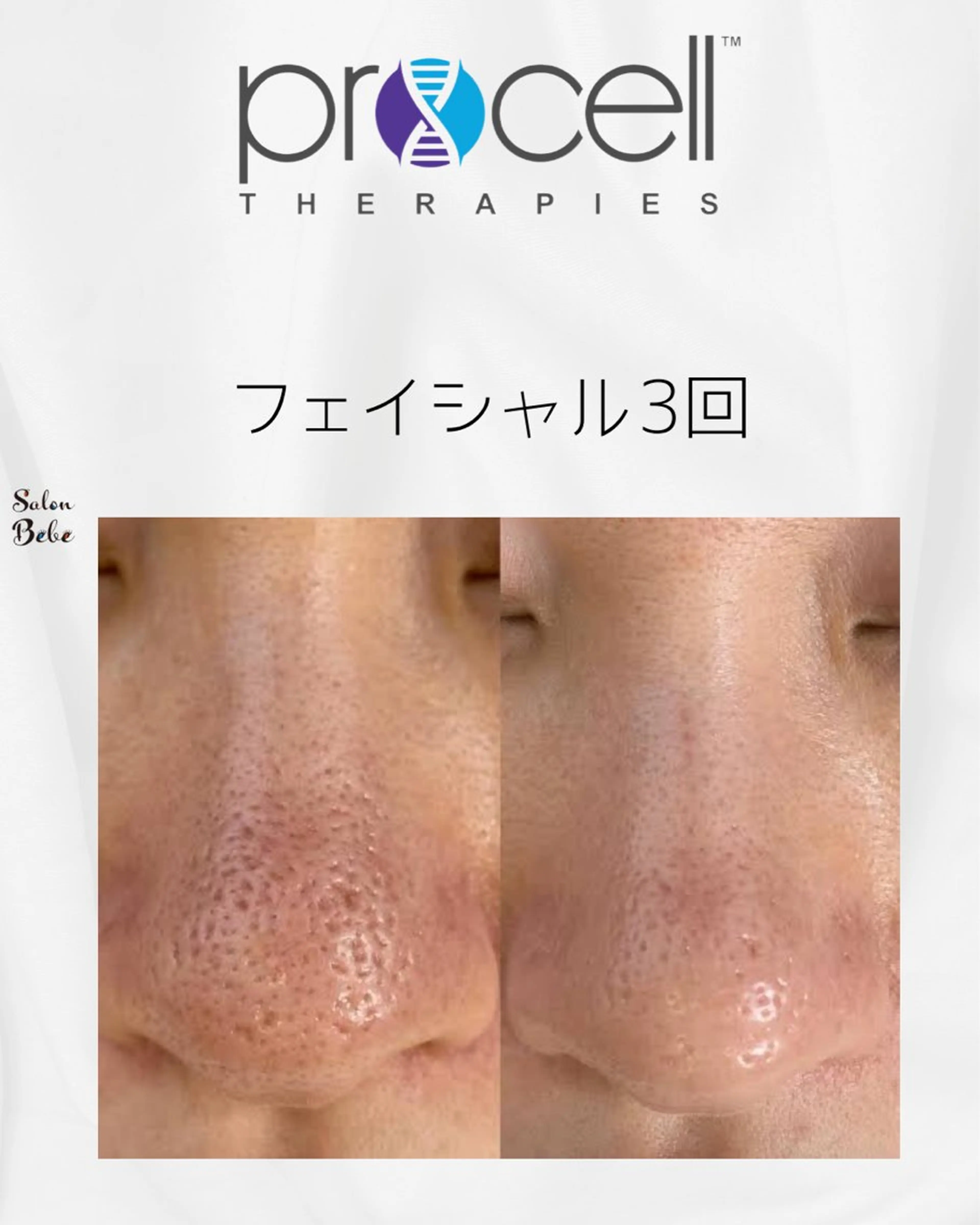 Salon Bebe 名古屋のエステ・リラクイメージ