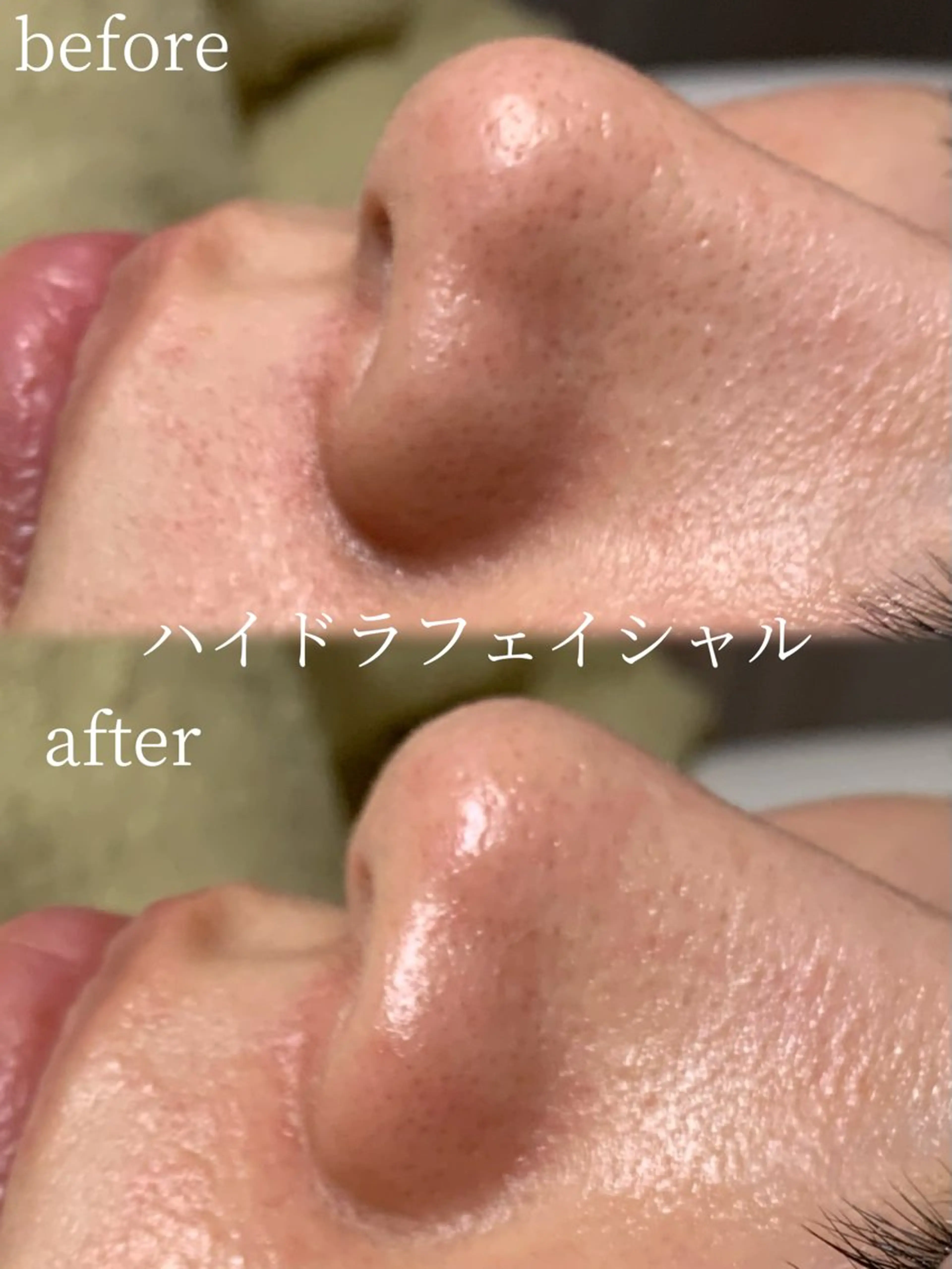 エステ リラク lifra CHISAのマツエク・マツパデザイン