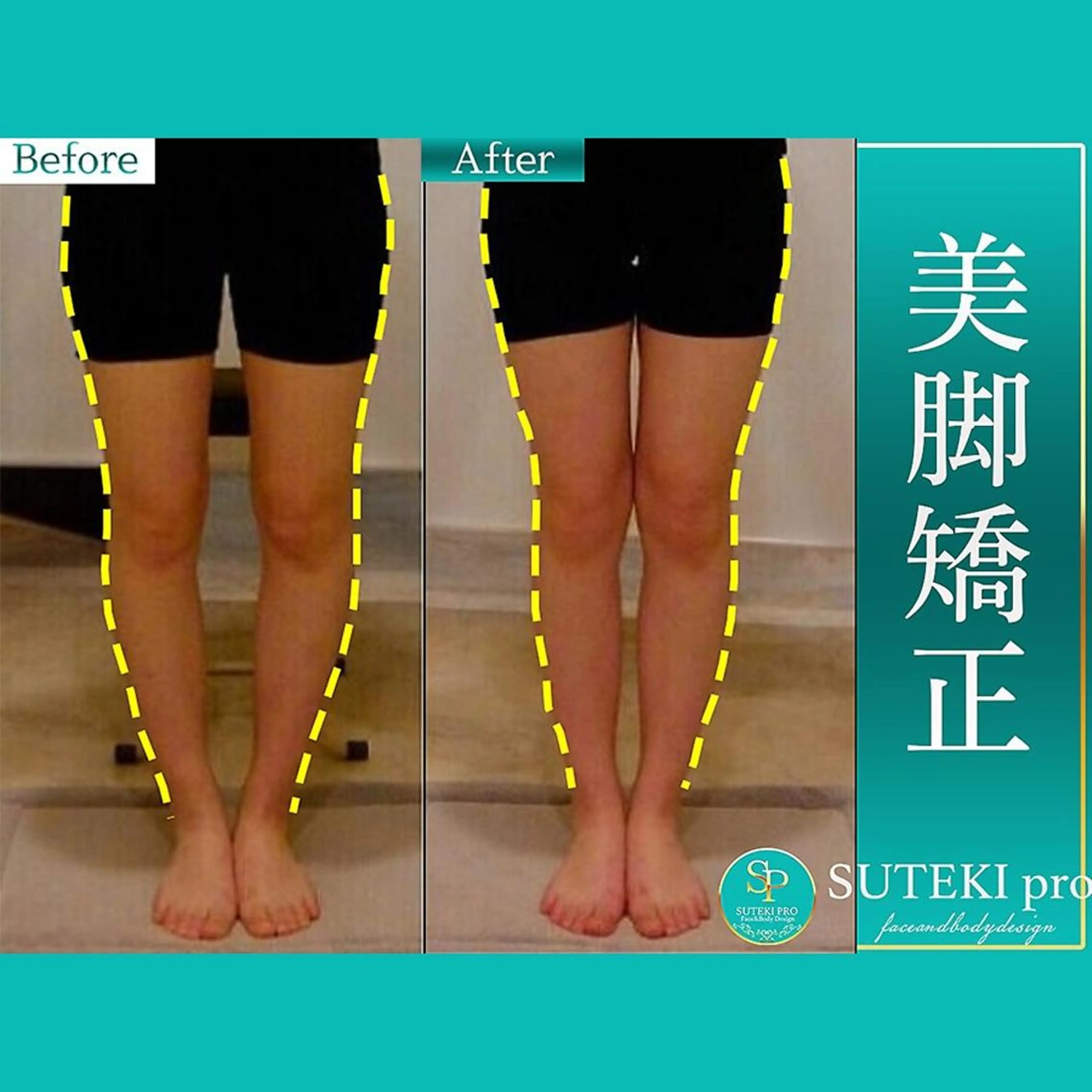 【下半身バランス整体】美脚ライン《骨盤矯正＆美脚大転子矯正》 ￥6600→ カウンセリング含む全体45分の写真