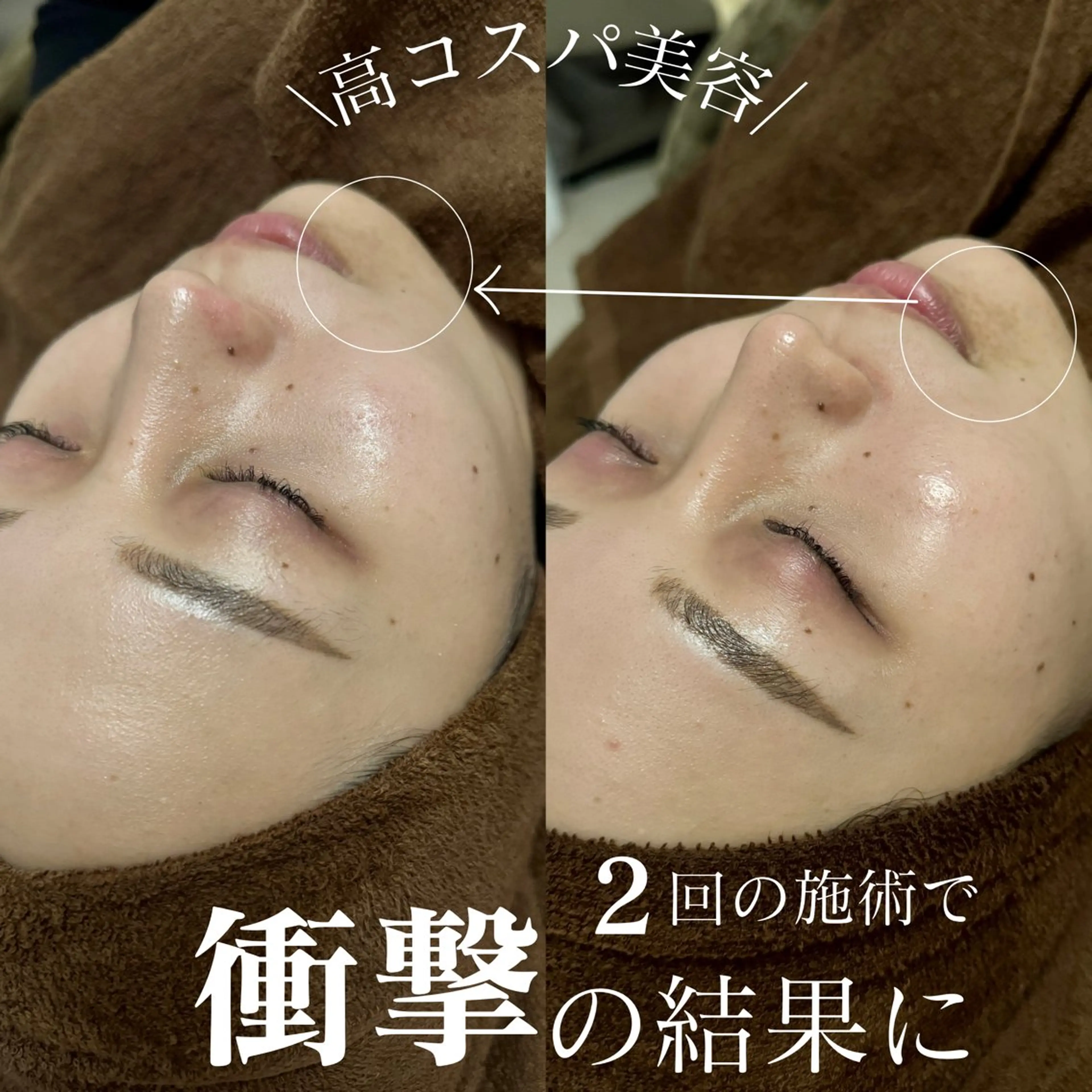 エステ 美肌salon GRAN CUORE所属・Natsuki🌙 GRAN CUOREのエステ・リラクイメージ