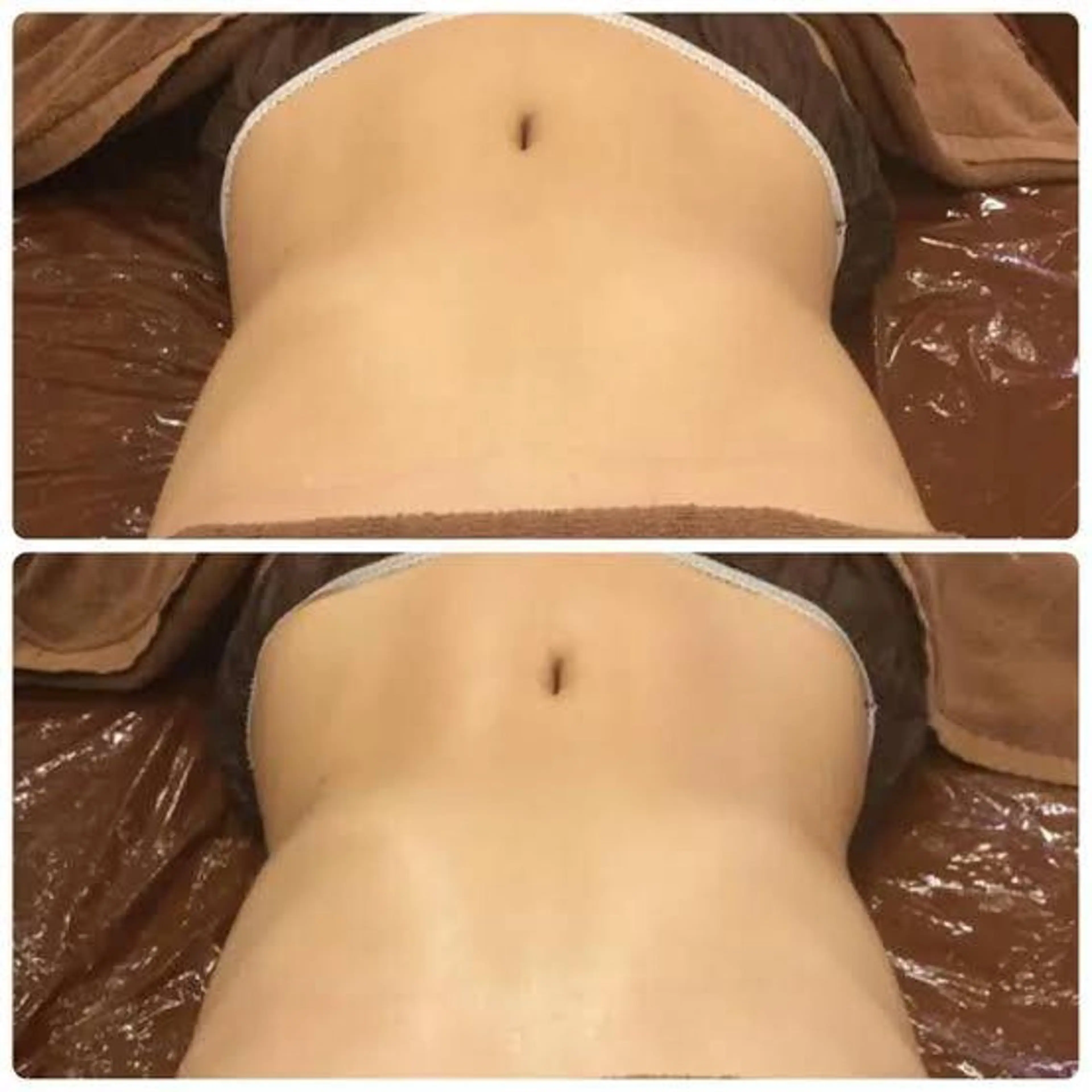 エステ リラク MyFairLady miuのエステ・リラクイメージ