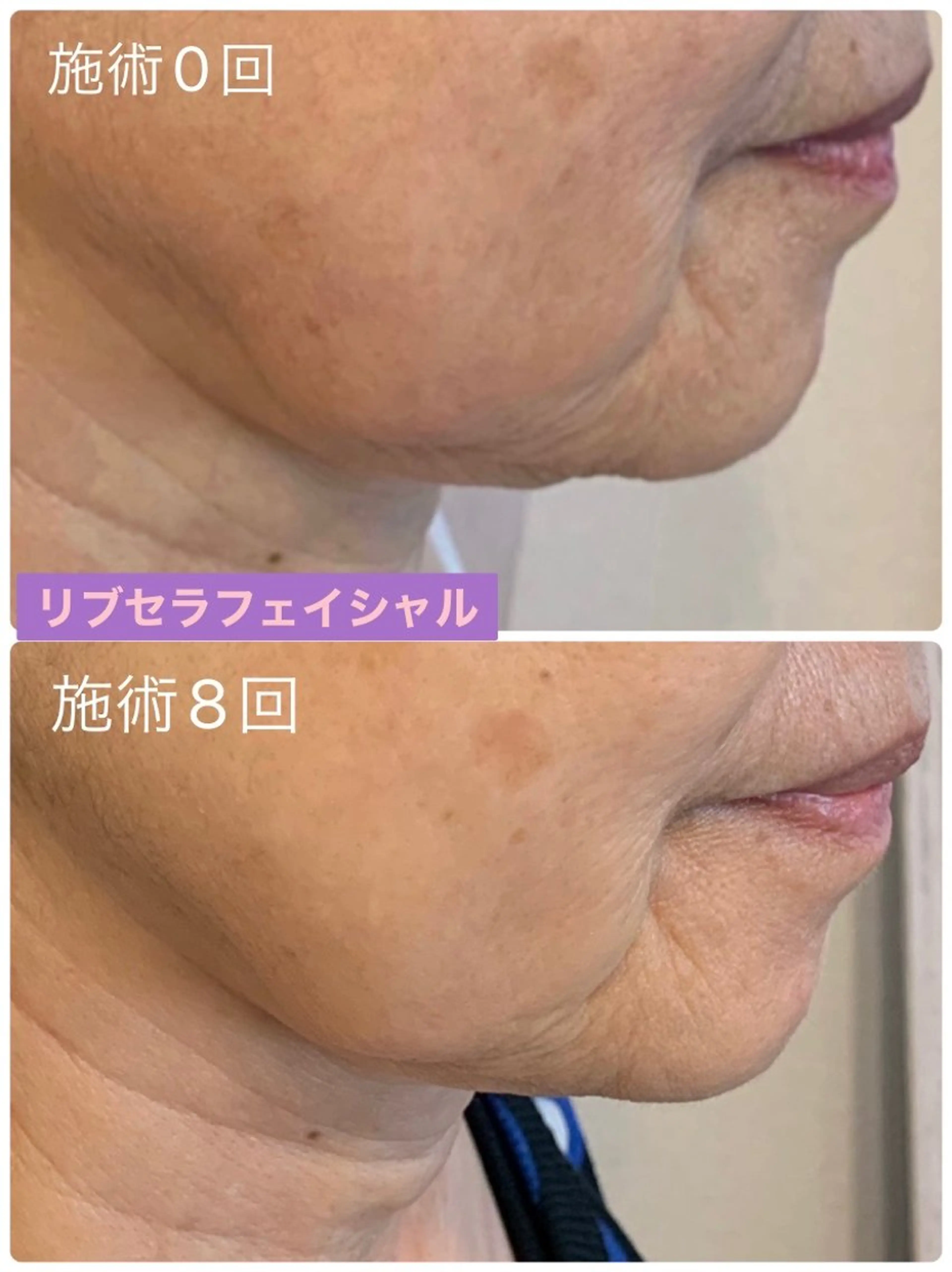 エステ Private Salon Prunelle所属・プライベートサロン プリュネルのエステ・リラクイメージ