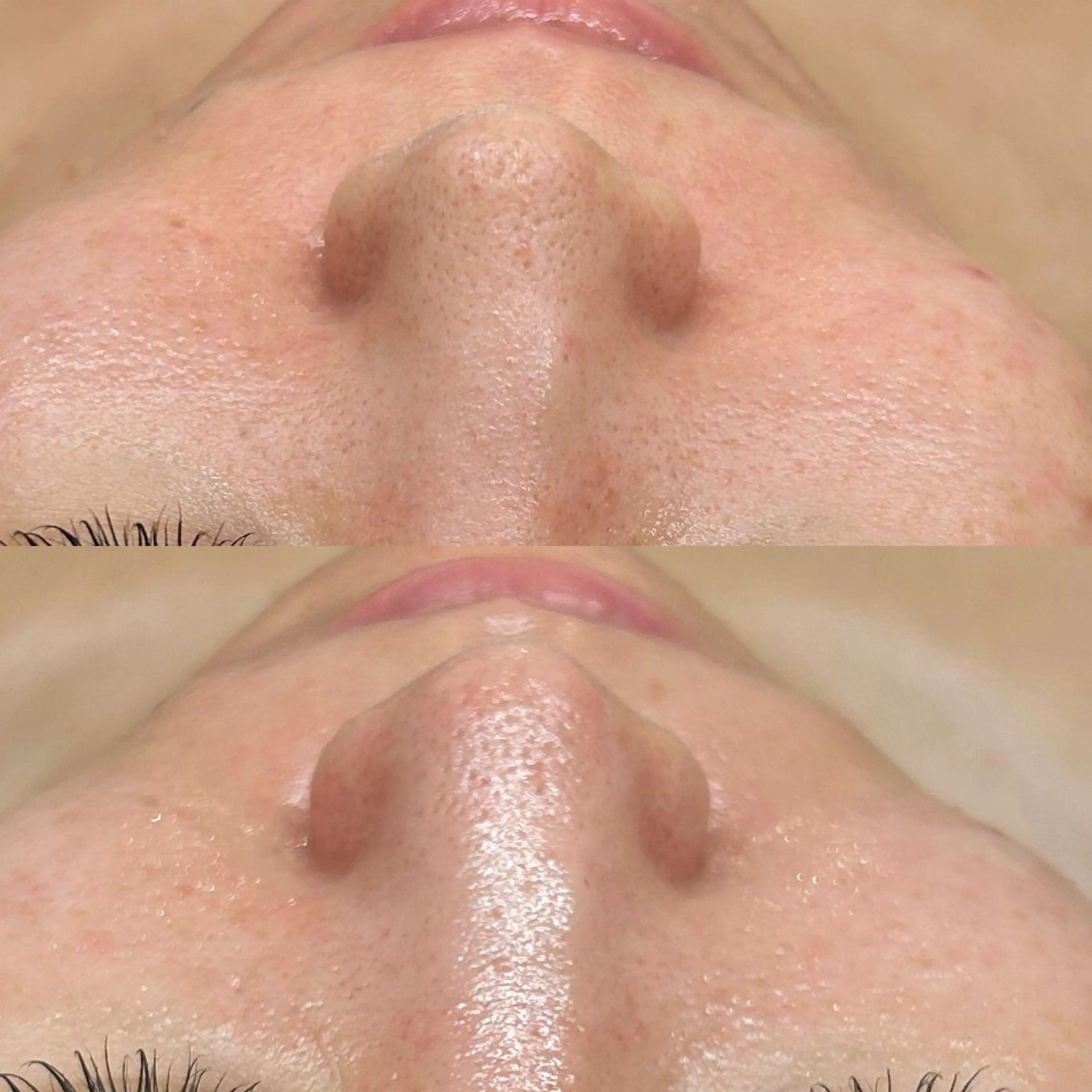 エステ 韓国🇰🇷価格 サロン_Nbibiのエステ・リラクイメージ