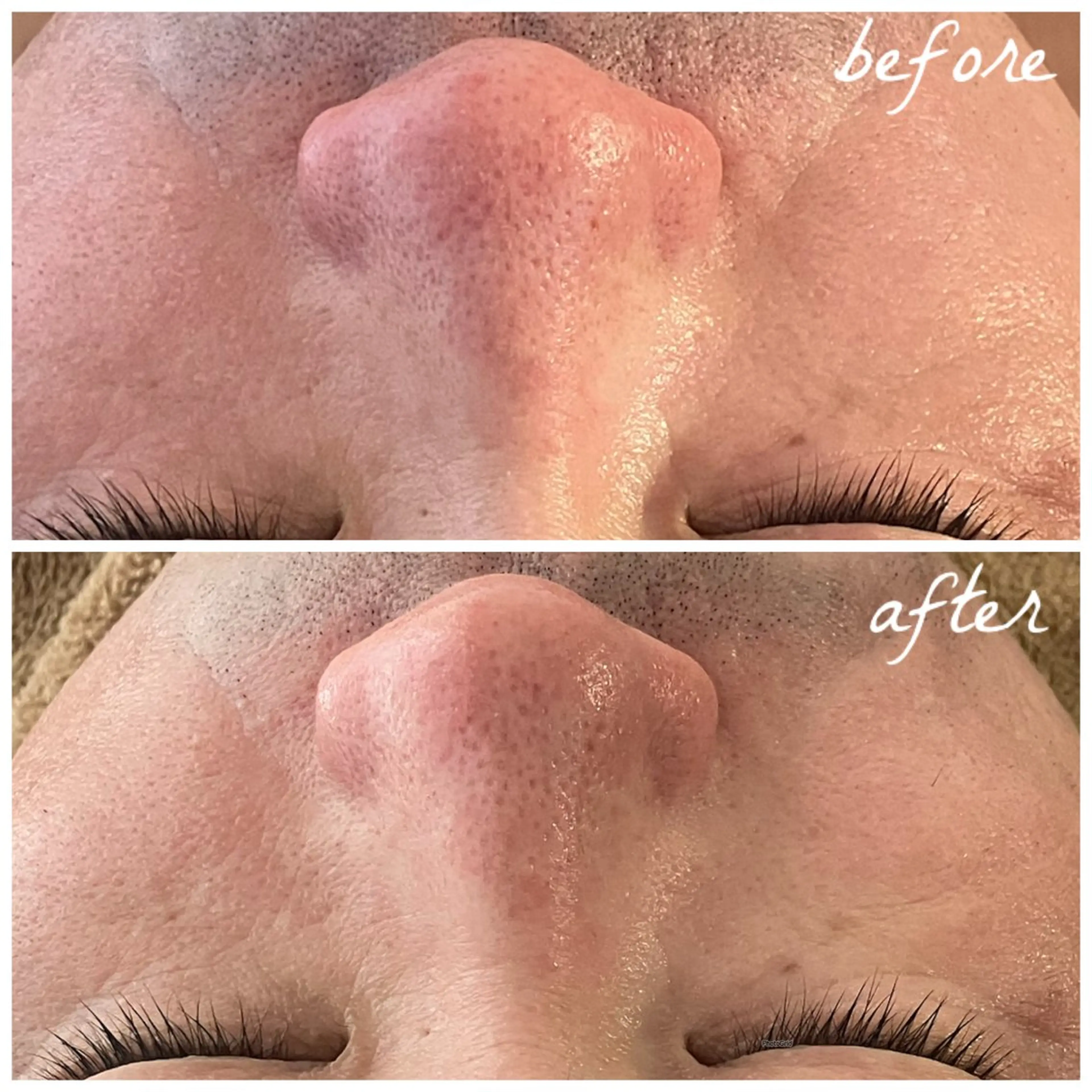 メンズ エステ メナード岐阜茜部 杉浦のエステ・リラクイメージ