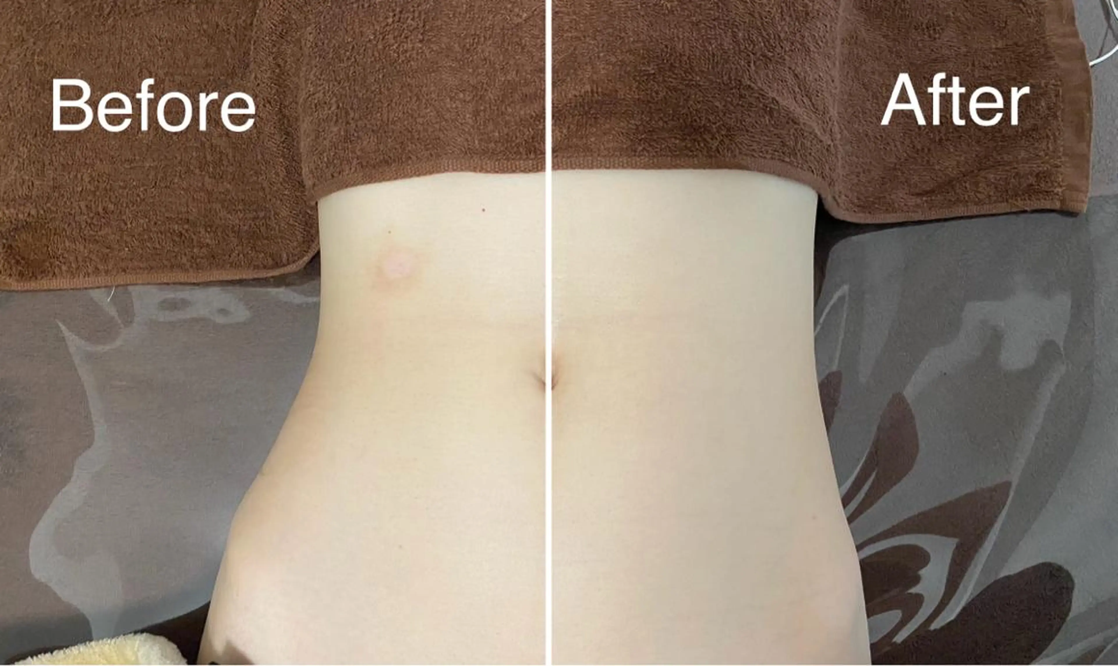 👙魅了するお腹の縦割れを👙美くびれケア 30分の写真