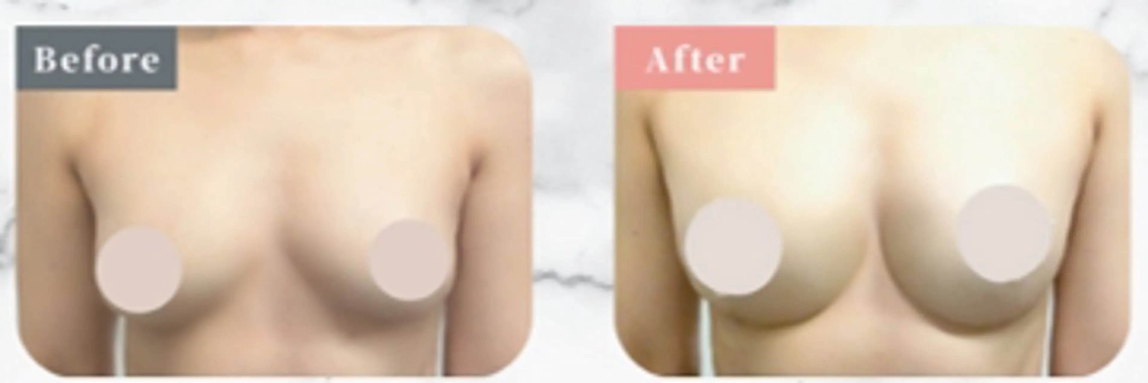 エステ Lumiere所属・横溝 夢結のエステ・リラクイメージ