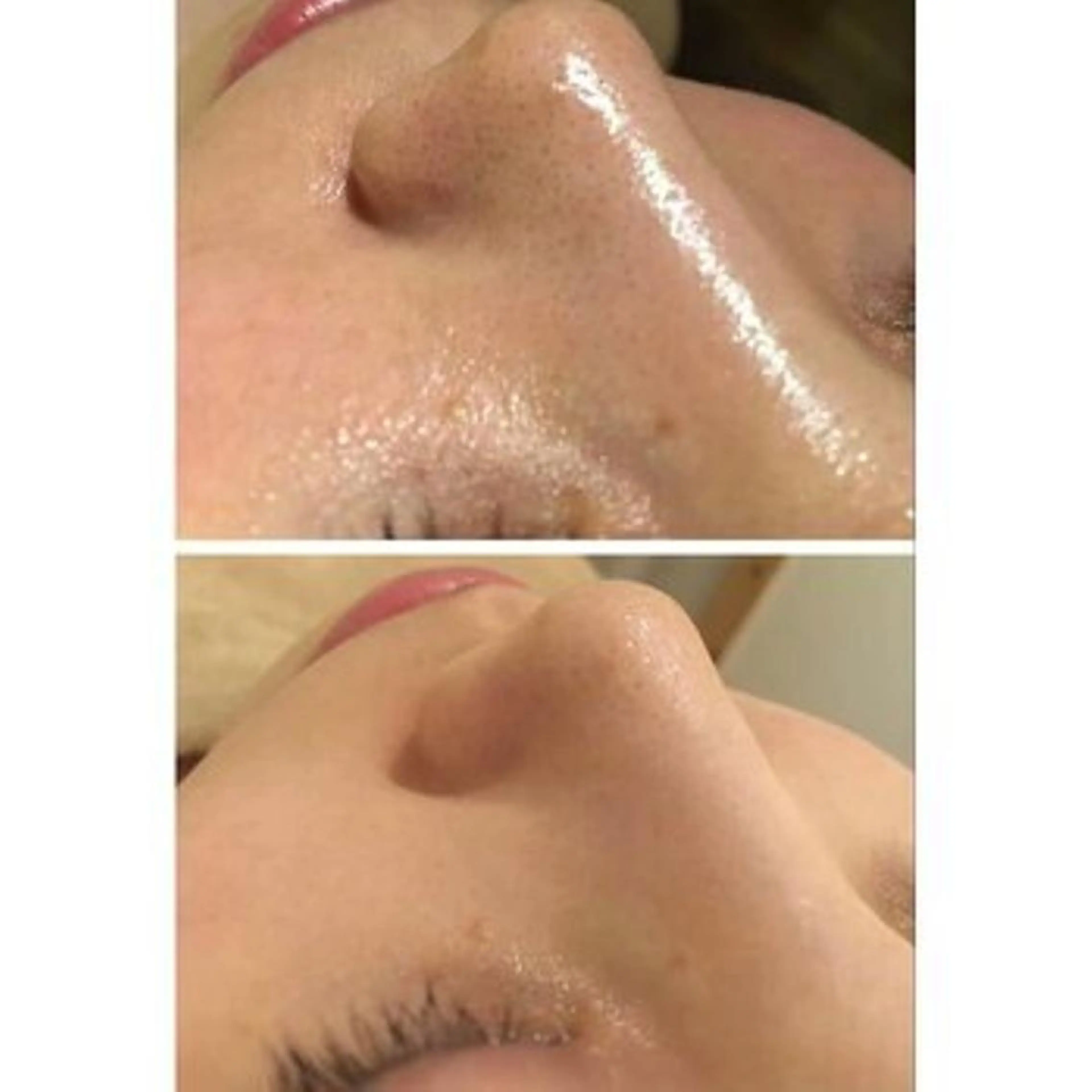 触れたくなる モテ肌へ...❤︎のエステ・リラクイメージ