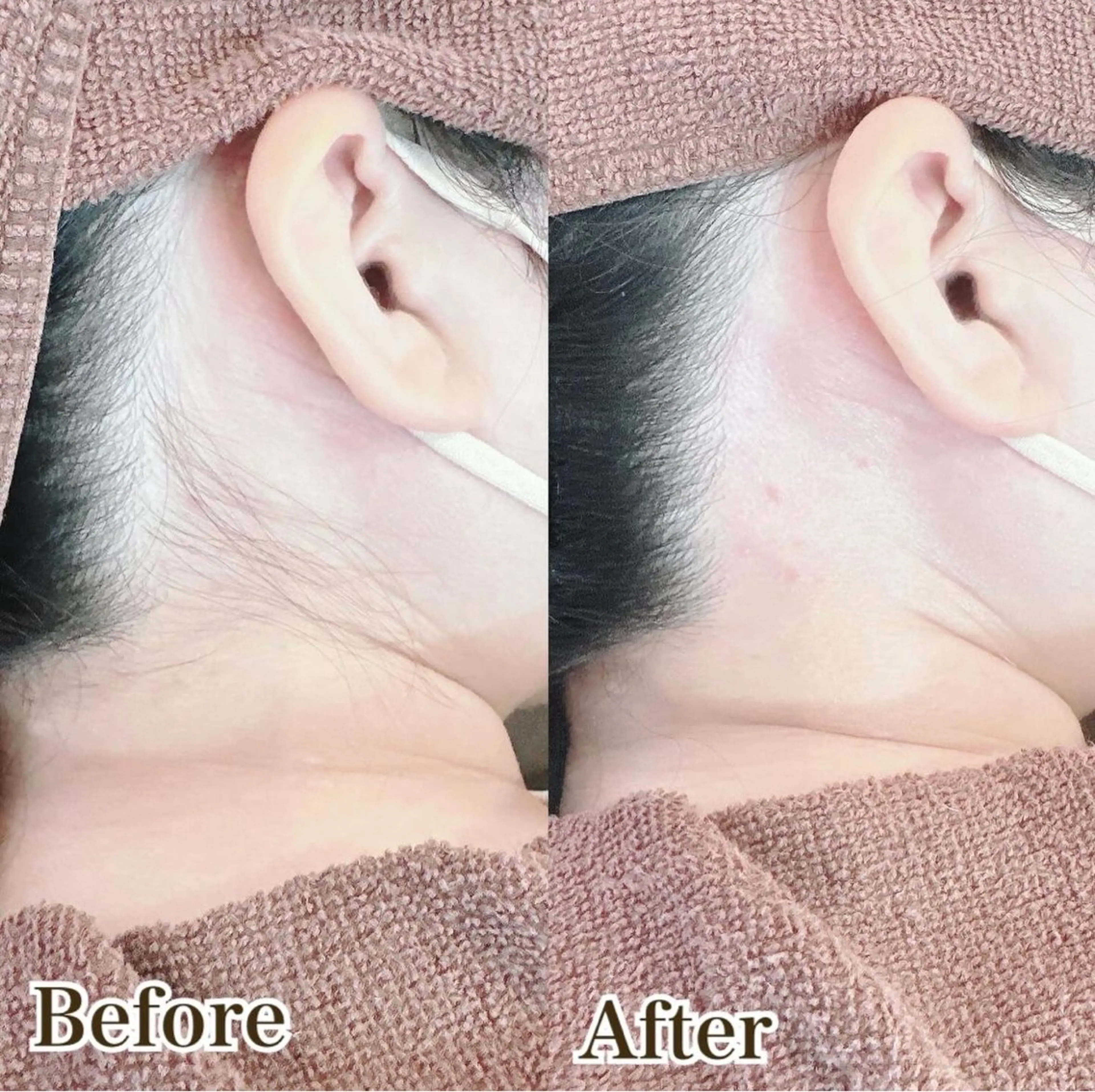 脱毛 金城 幸のエステ・リラクイメージ