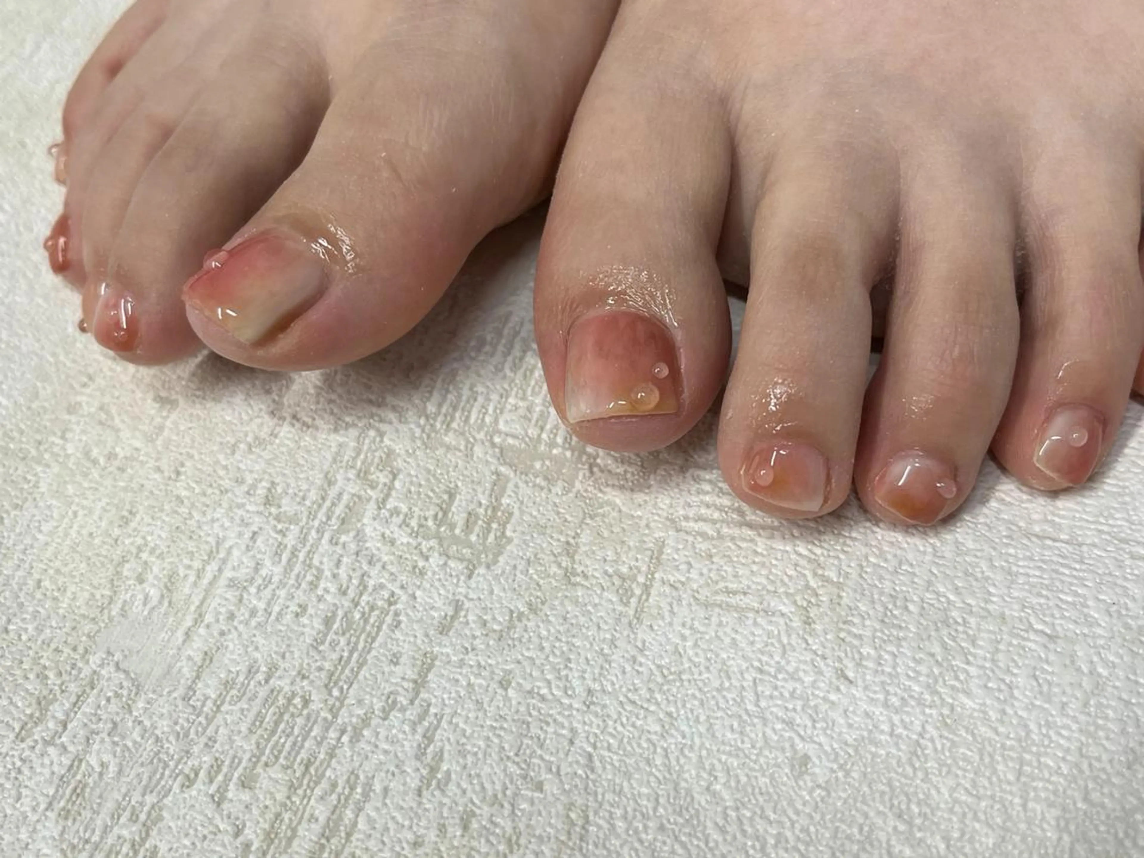 【オフ無料ケア込み&フットバス付き】Foot 相談メニュー¥8000~11000の写真