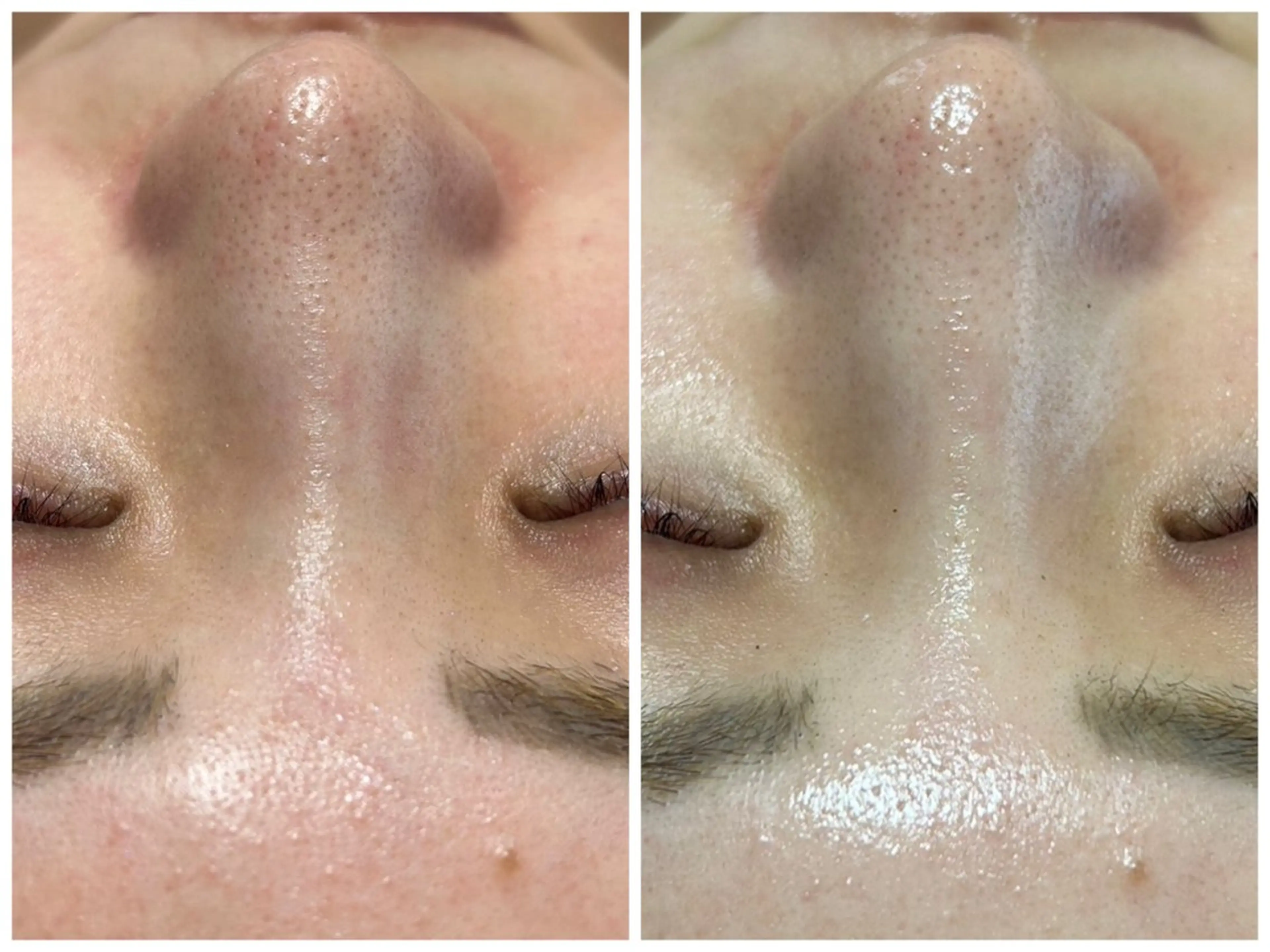 WHITE AQUA 🌼柏店のエステ・リラクイメージ