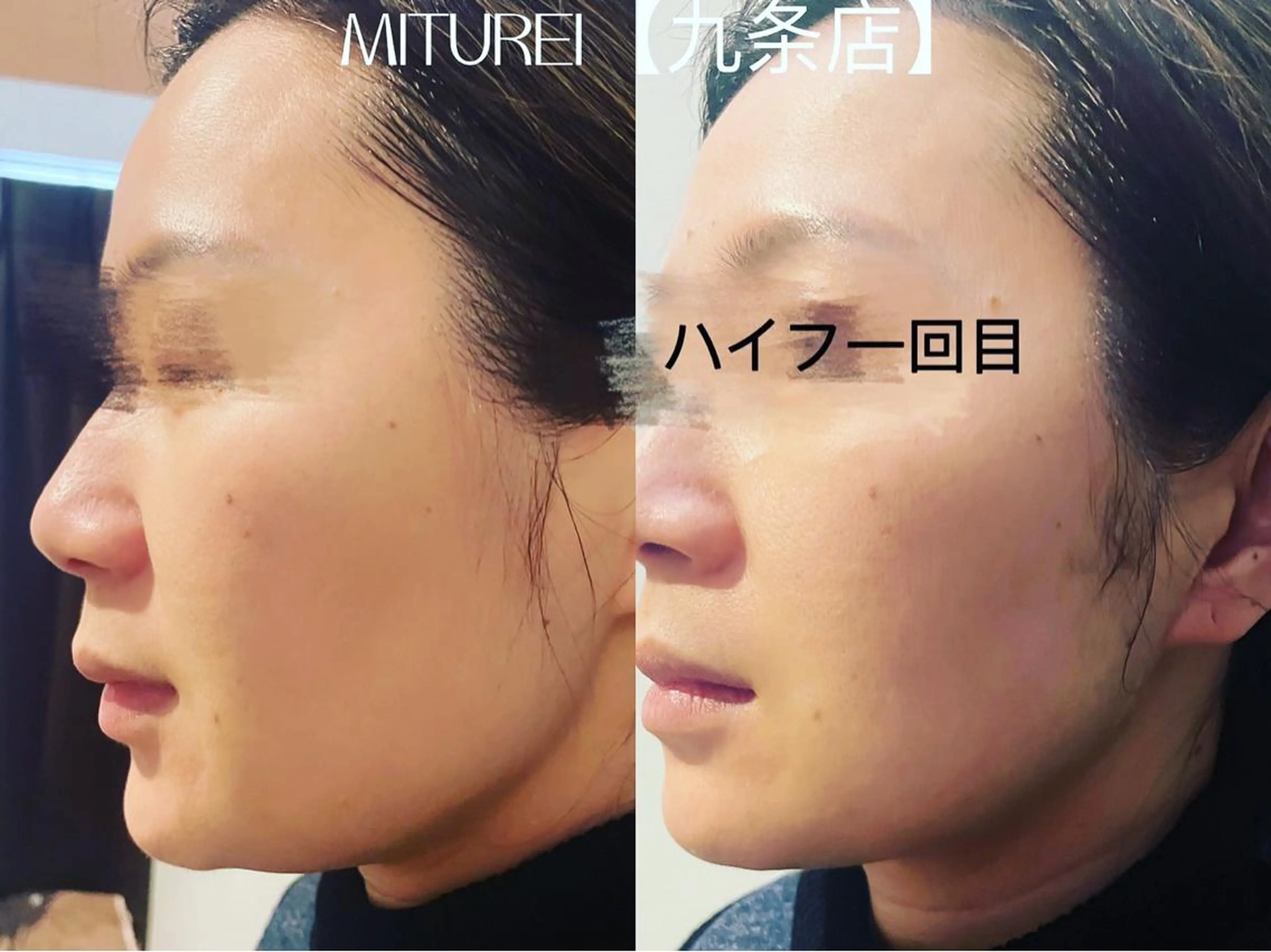 西区九条エステ MITUREIサロンのエステ・リラクイメージ