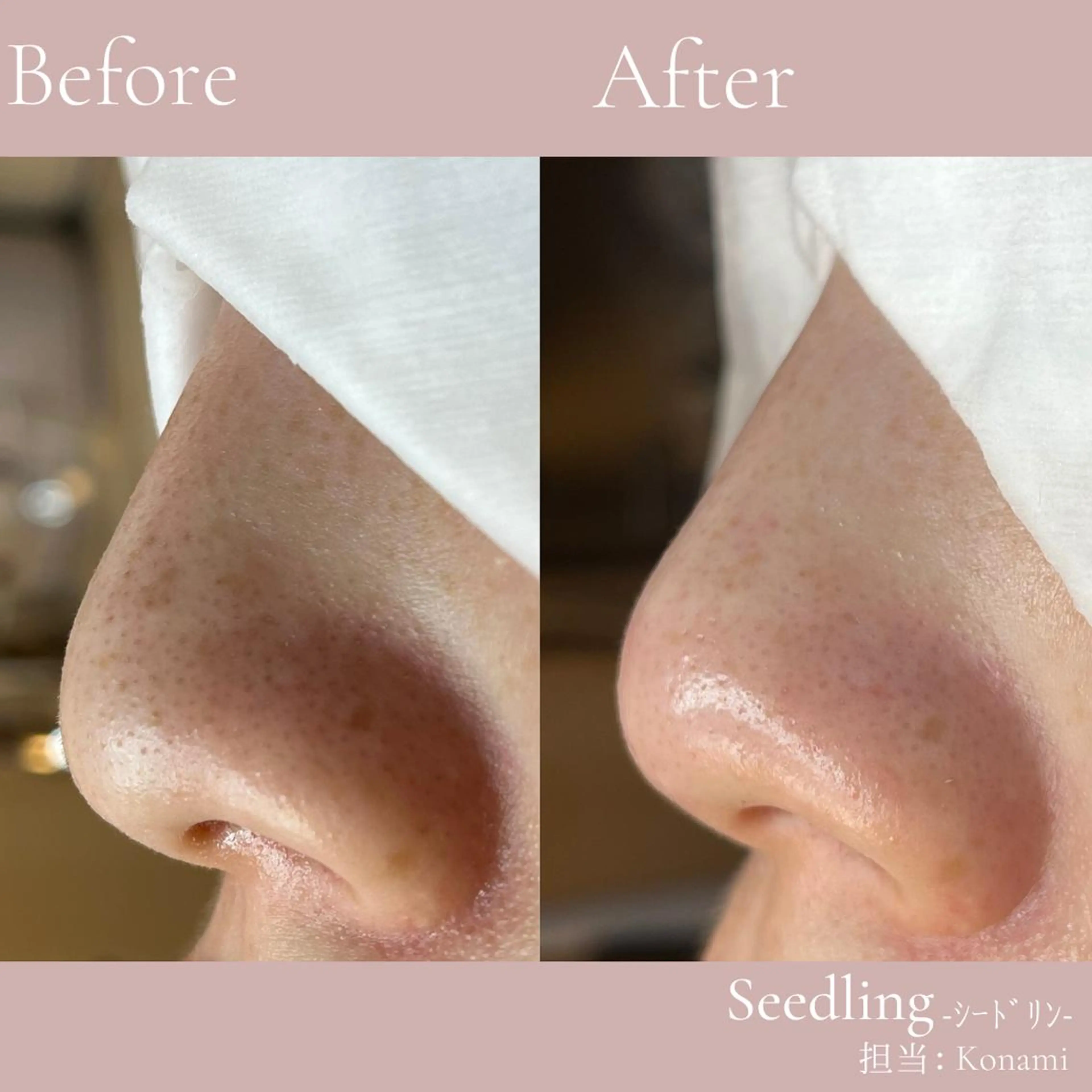 エステ シードリン 府内店 小波のエステ・リラクイメージ