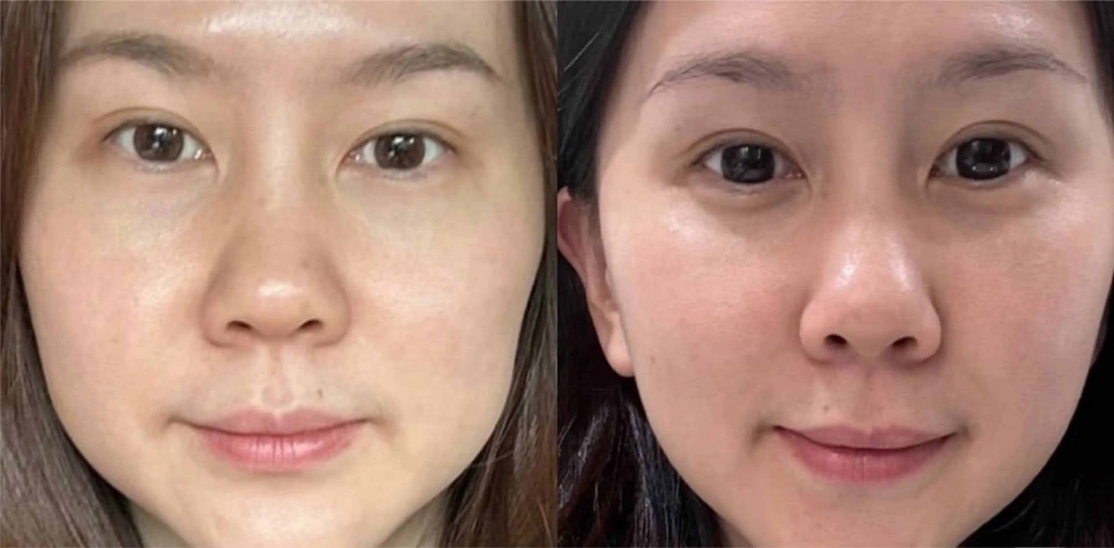 マツエク・マツパ エステ リラク 愛維美水光美肌専門店所属・愛維美水光美肌専門店 メンズレディースokのエステ・リラクイメージ